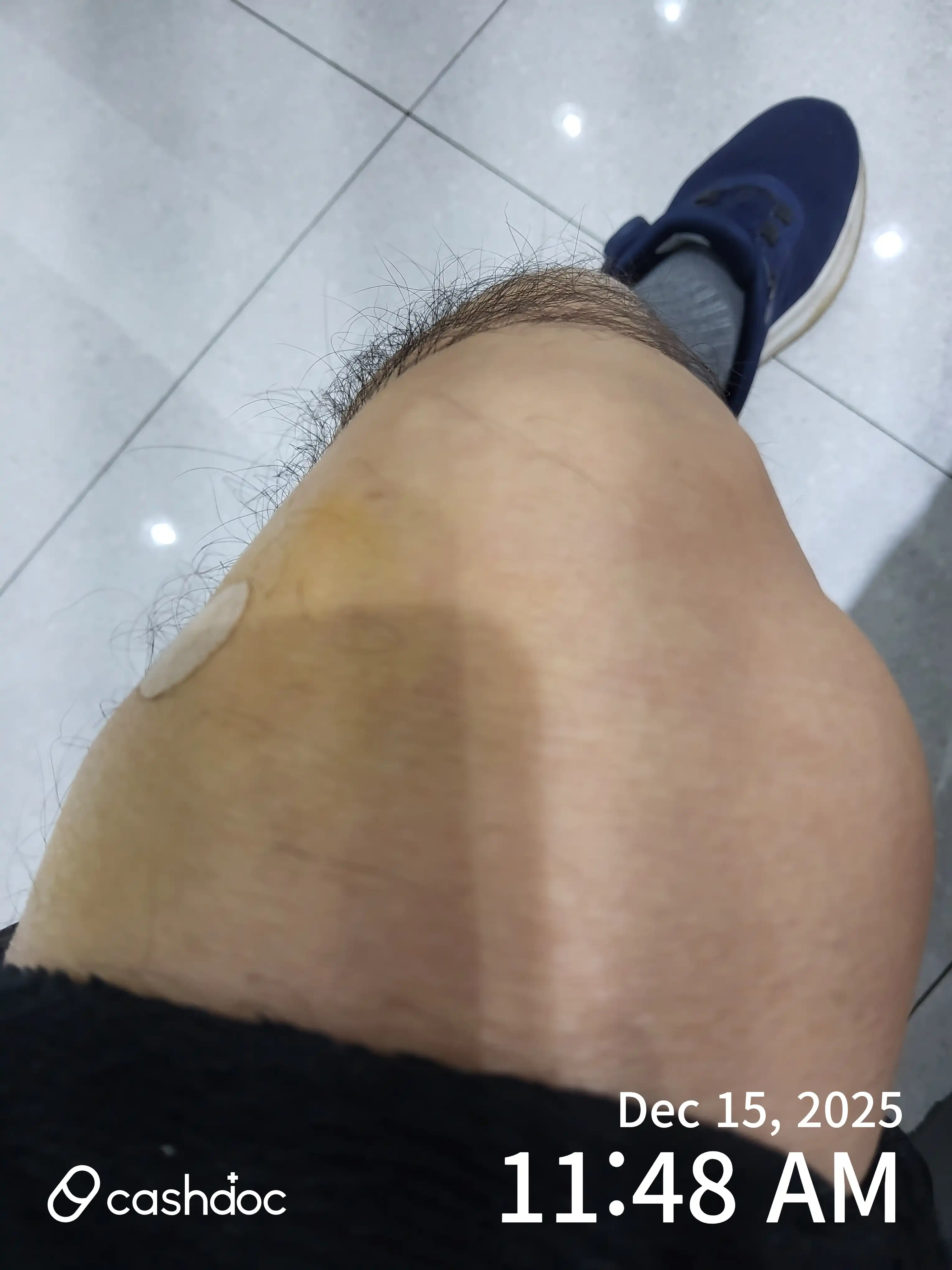 评价照片