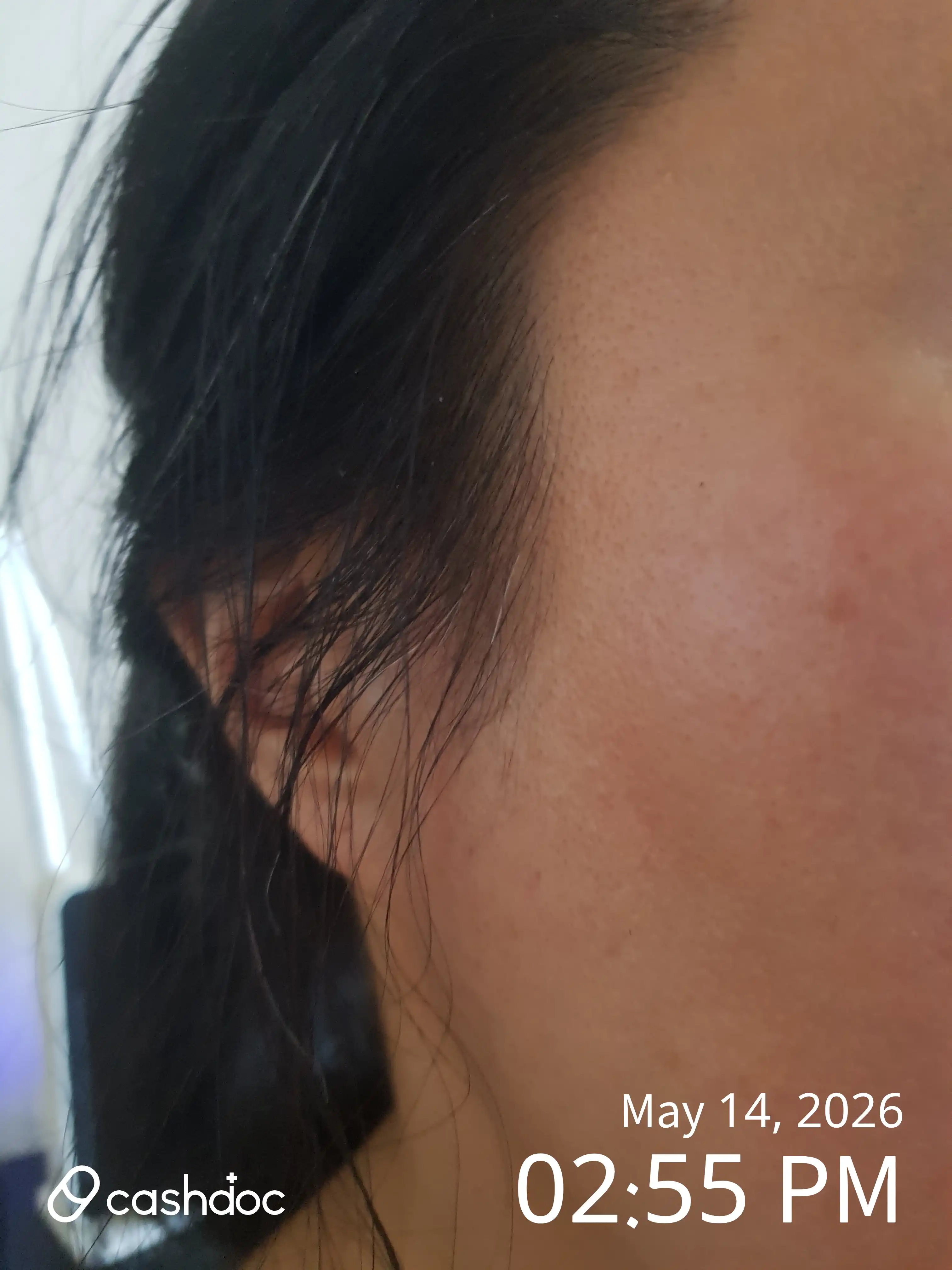 Review photo
