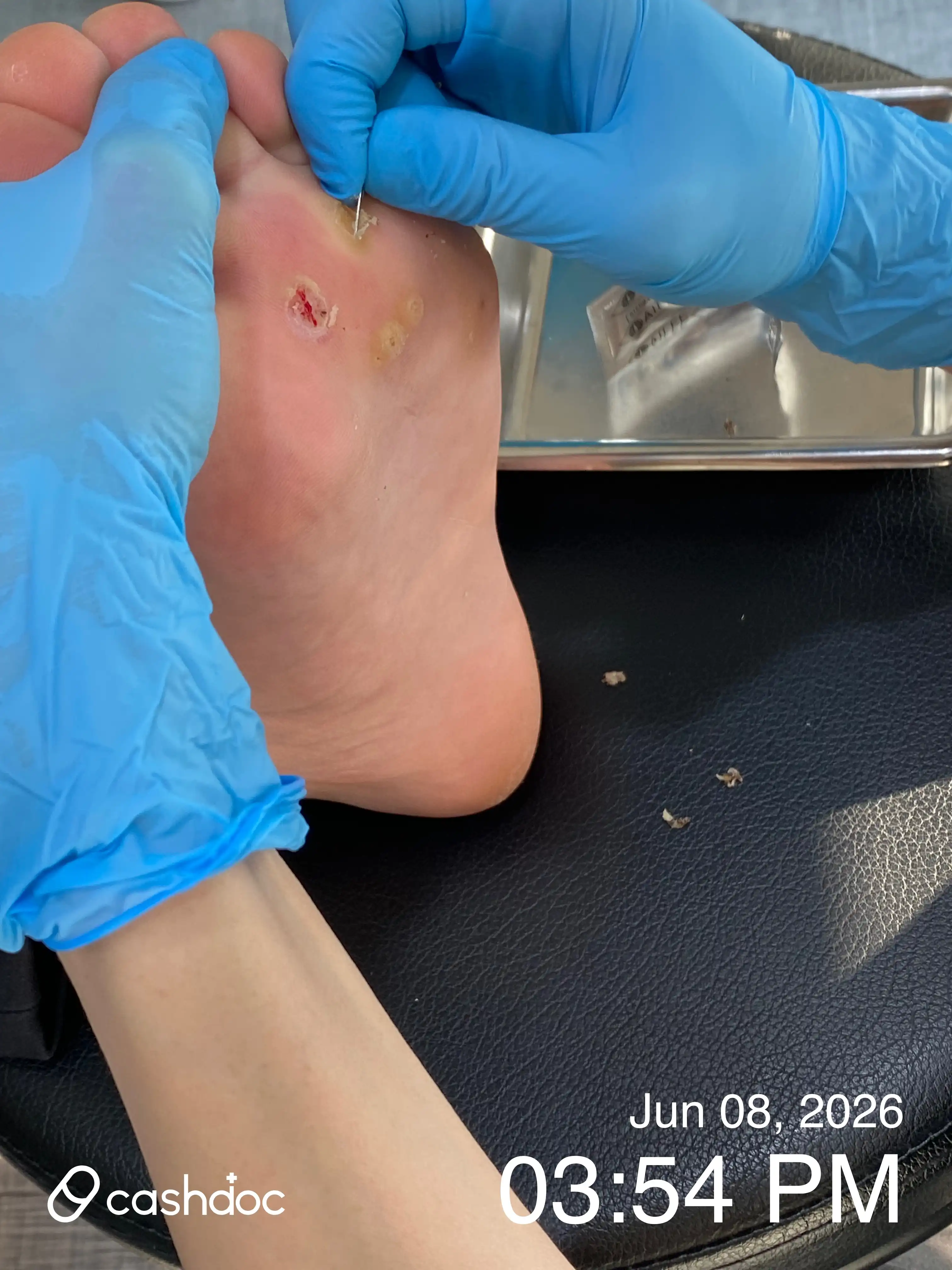 评价照片