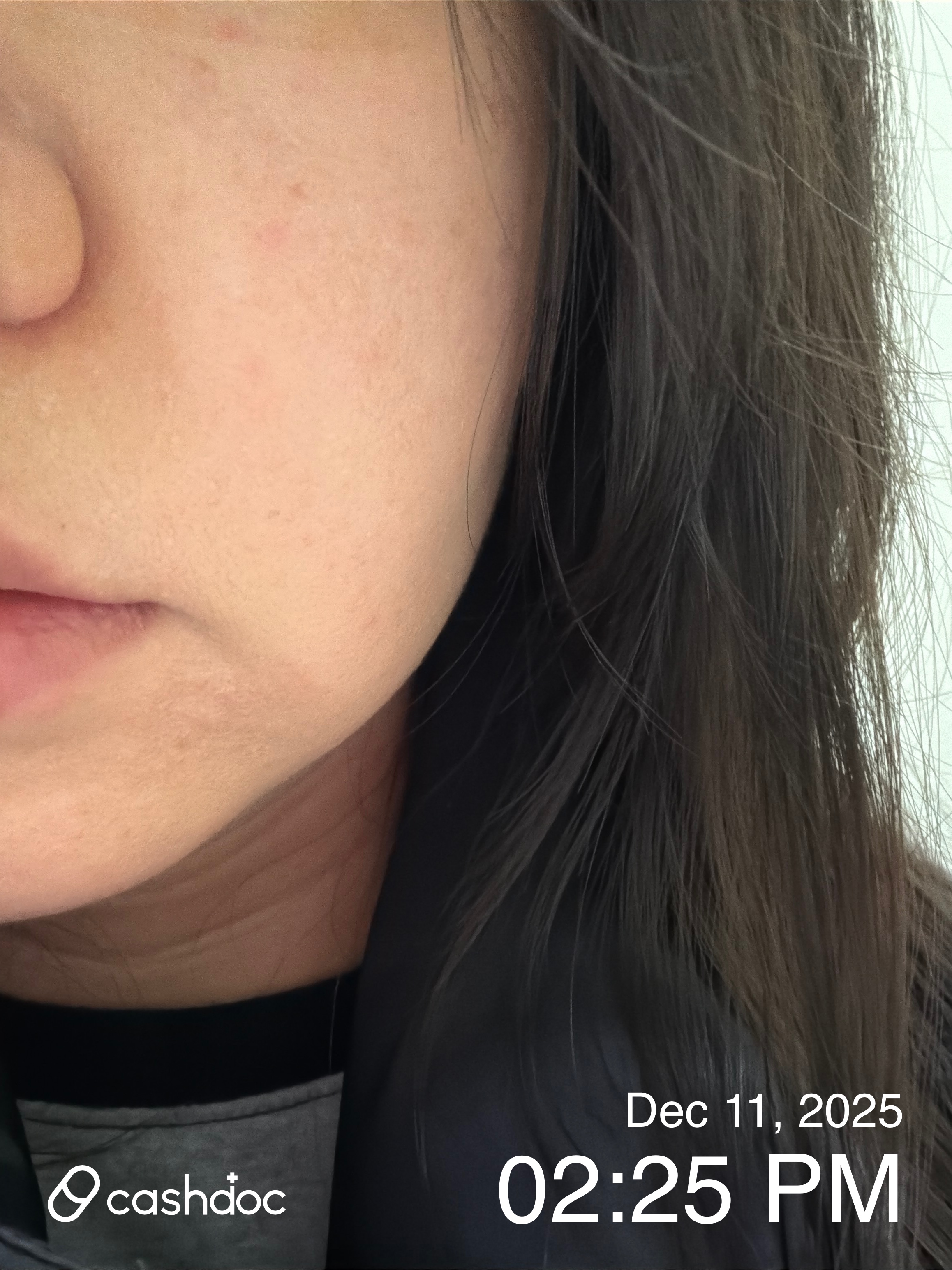 전주시 수경피부과, 긴 대기 끝에 안정된 알러지 반응