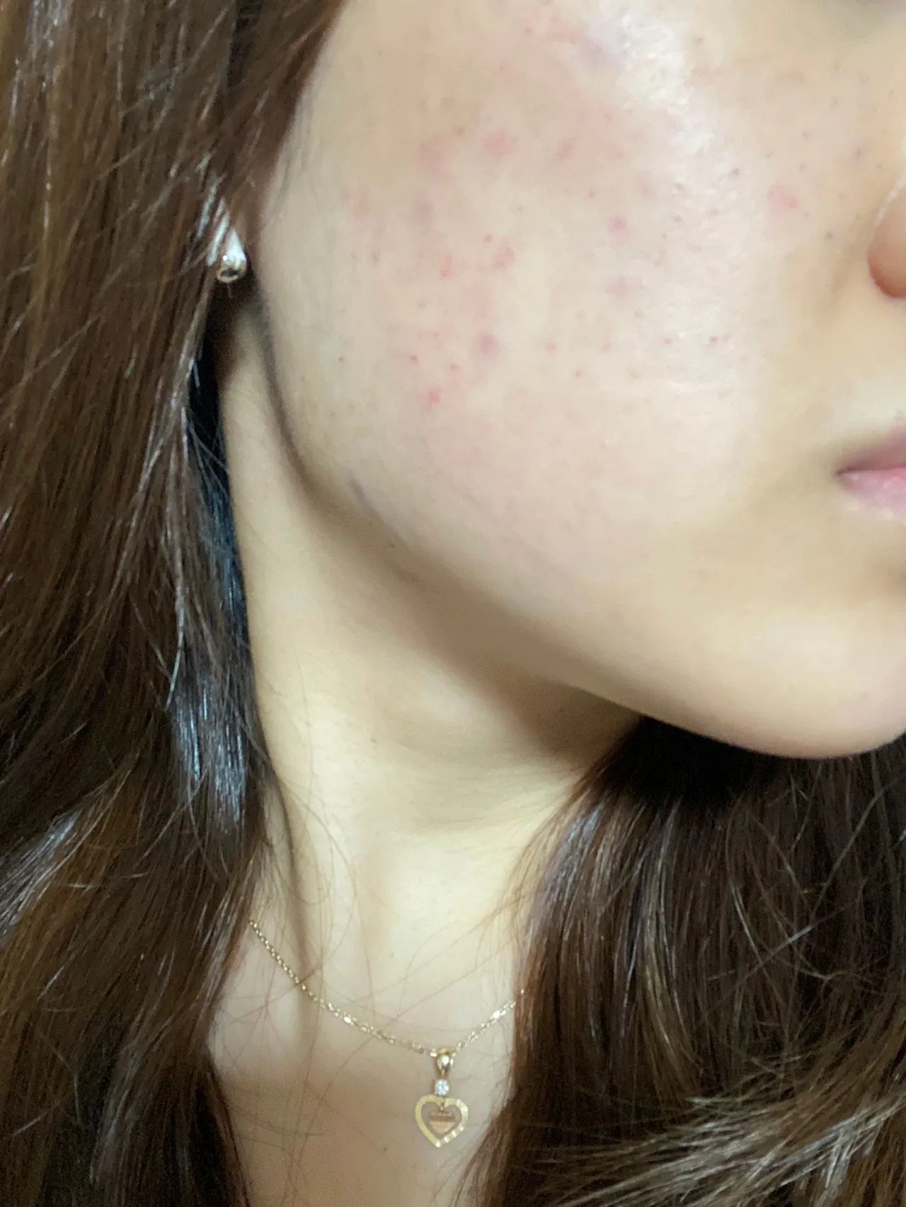 시술 전 사진