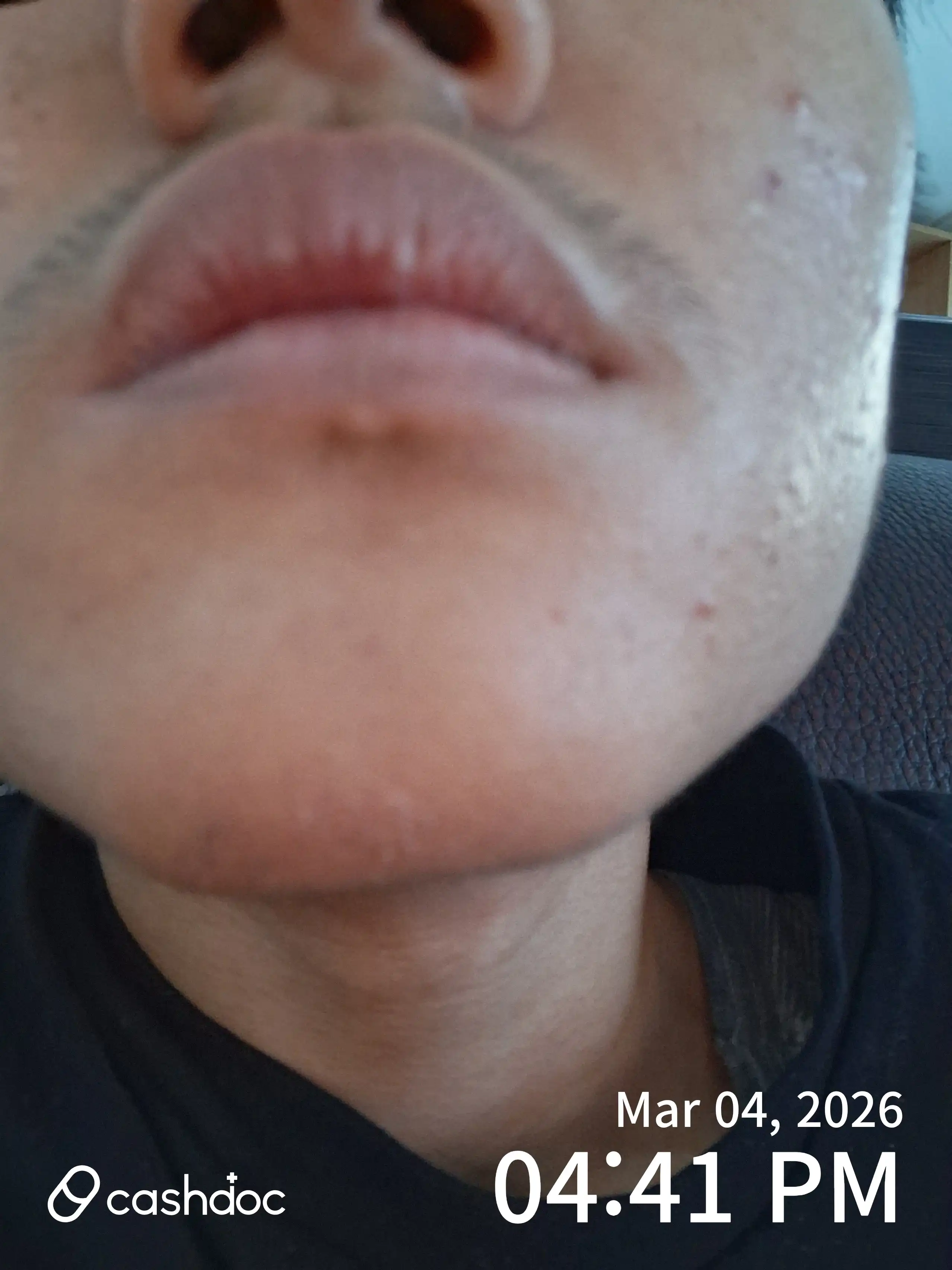 Review photo