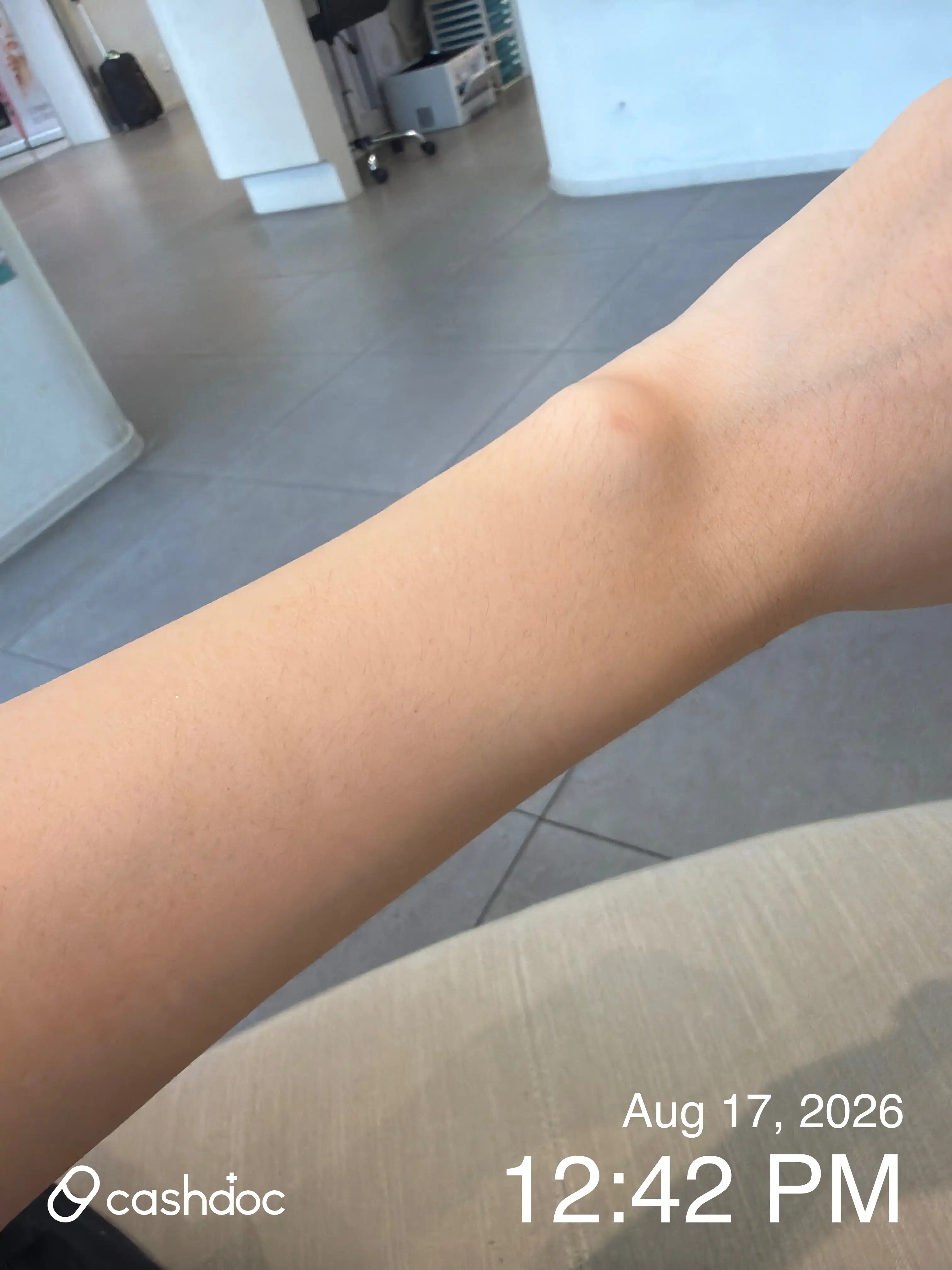 Review photo