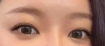 후
