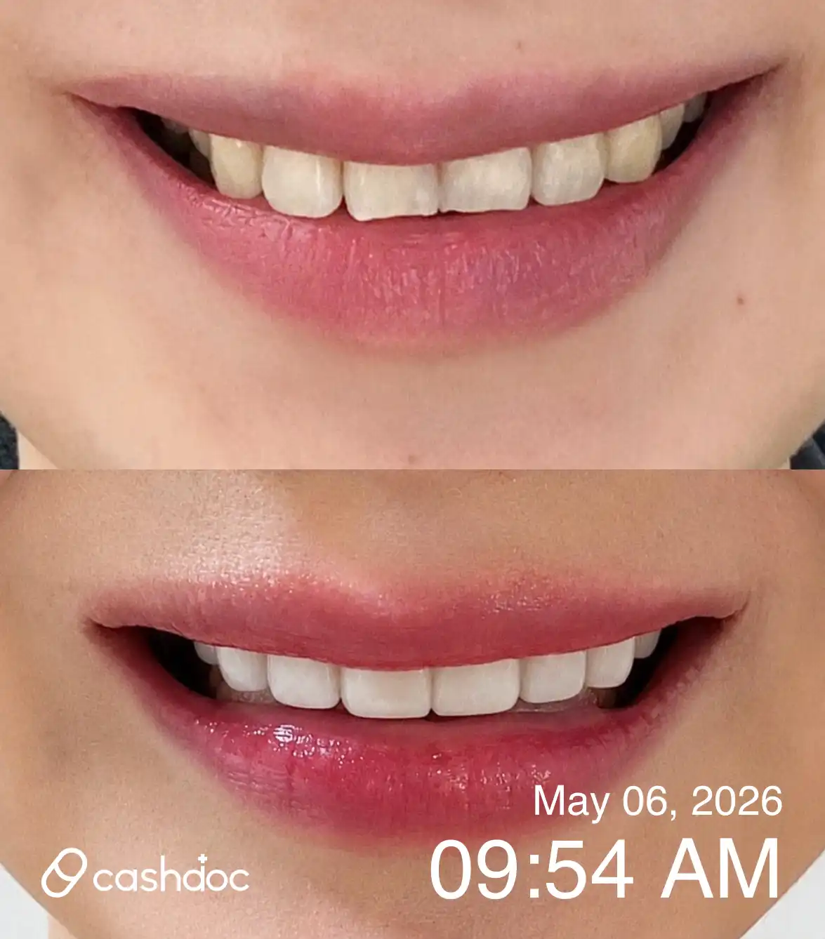 Review photo