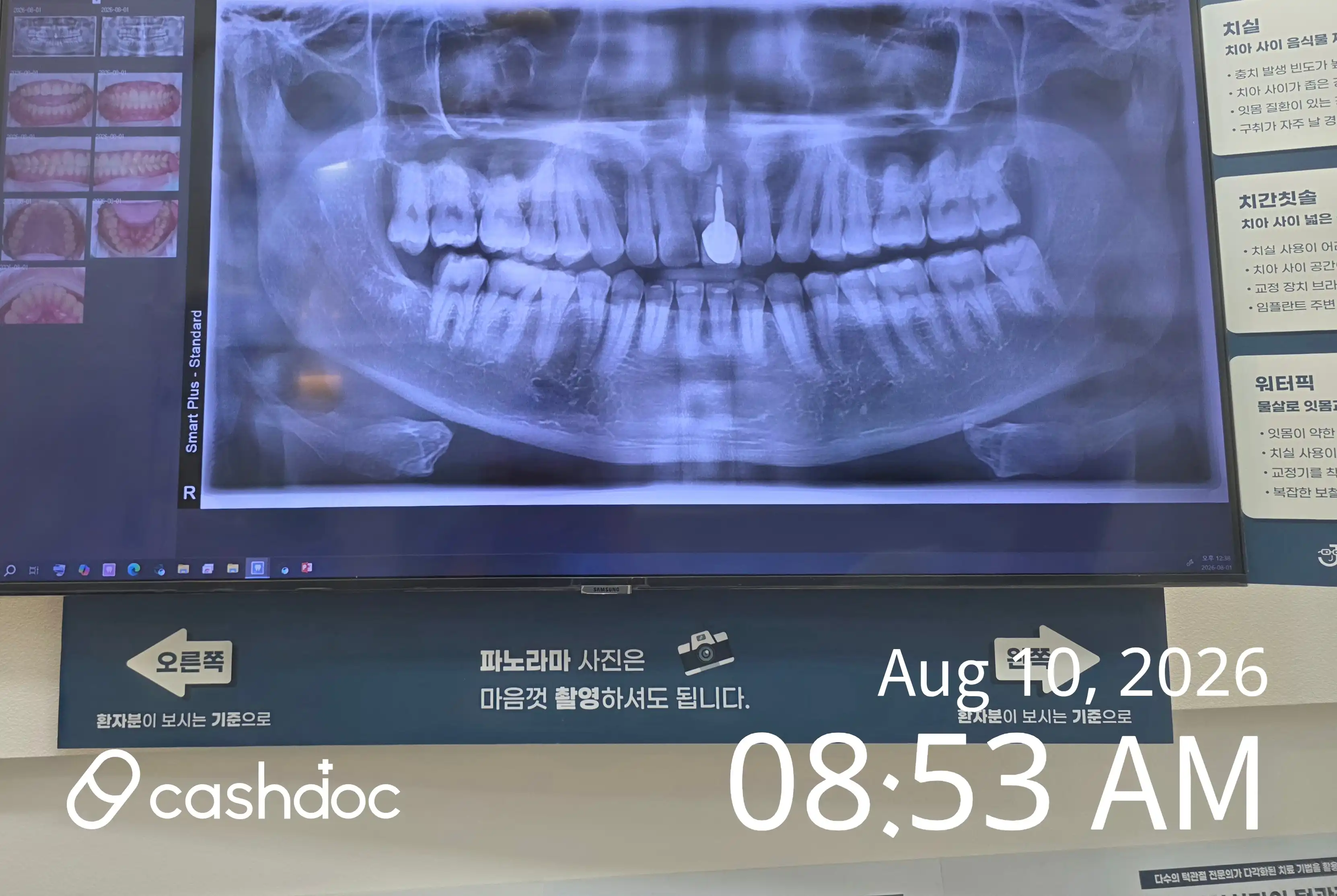 리뷰 사진