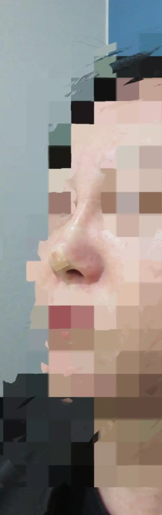 후