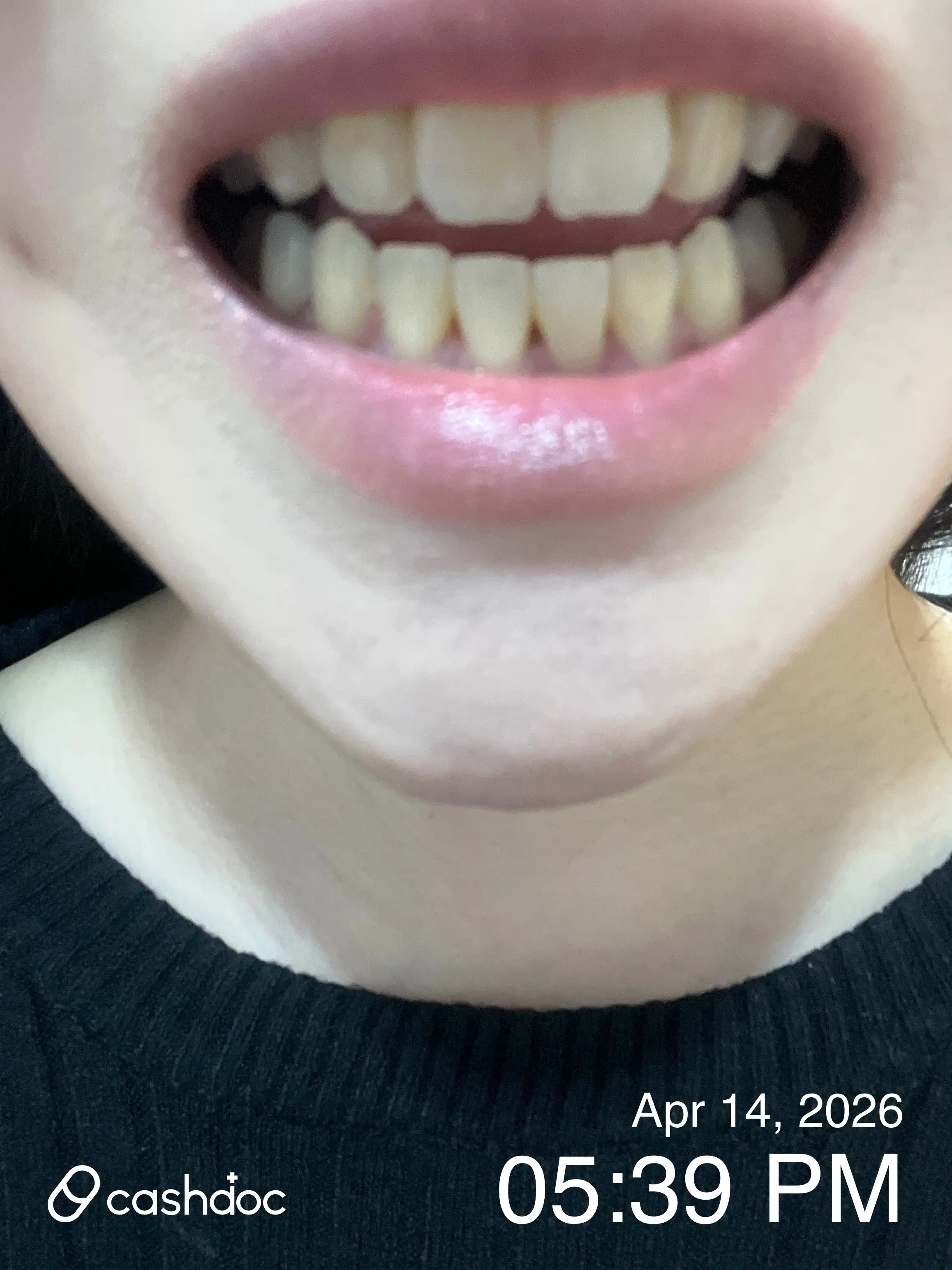 Review photo