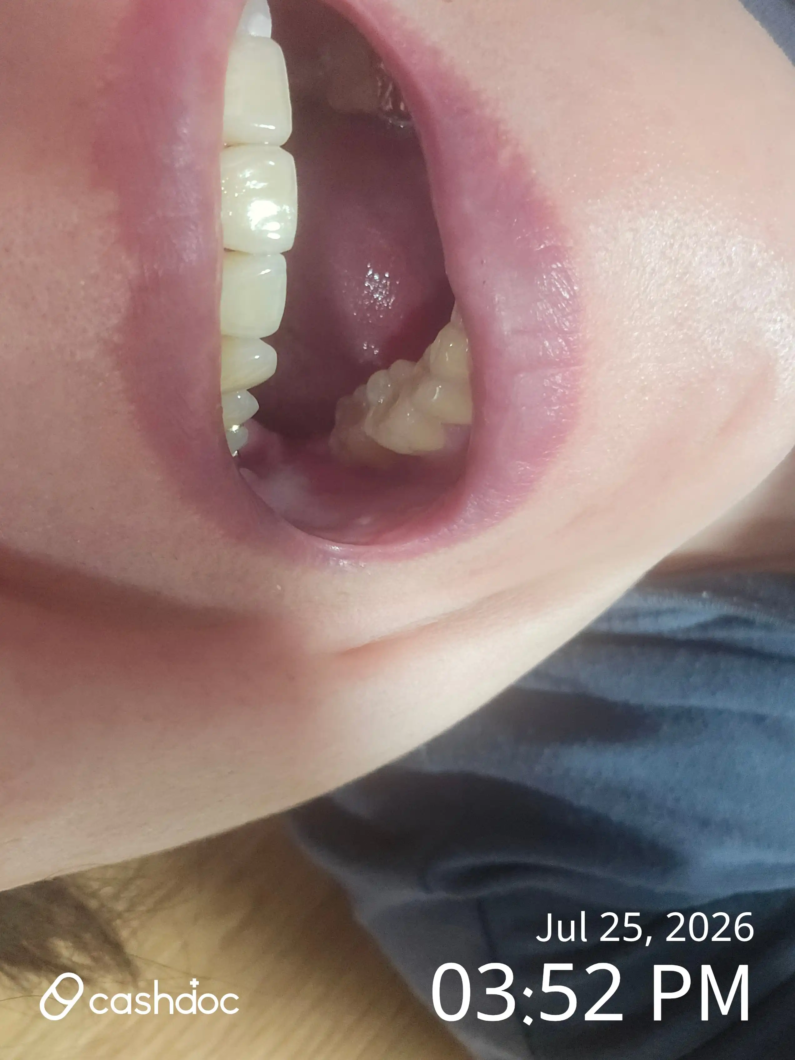 Review photo