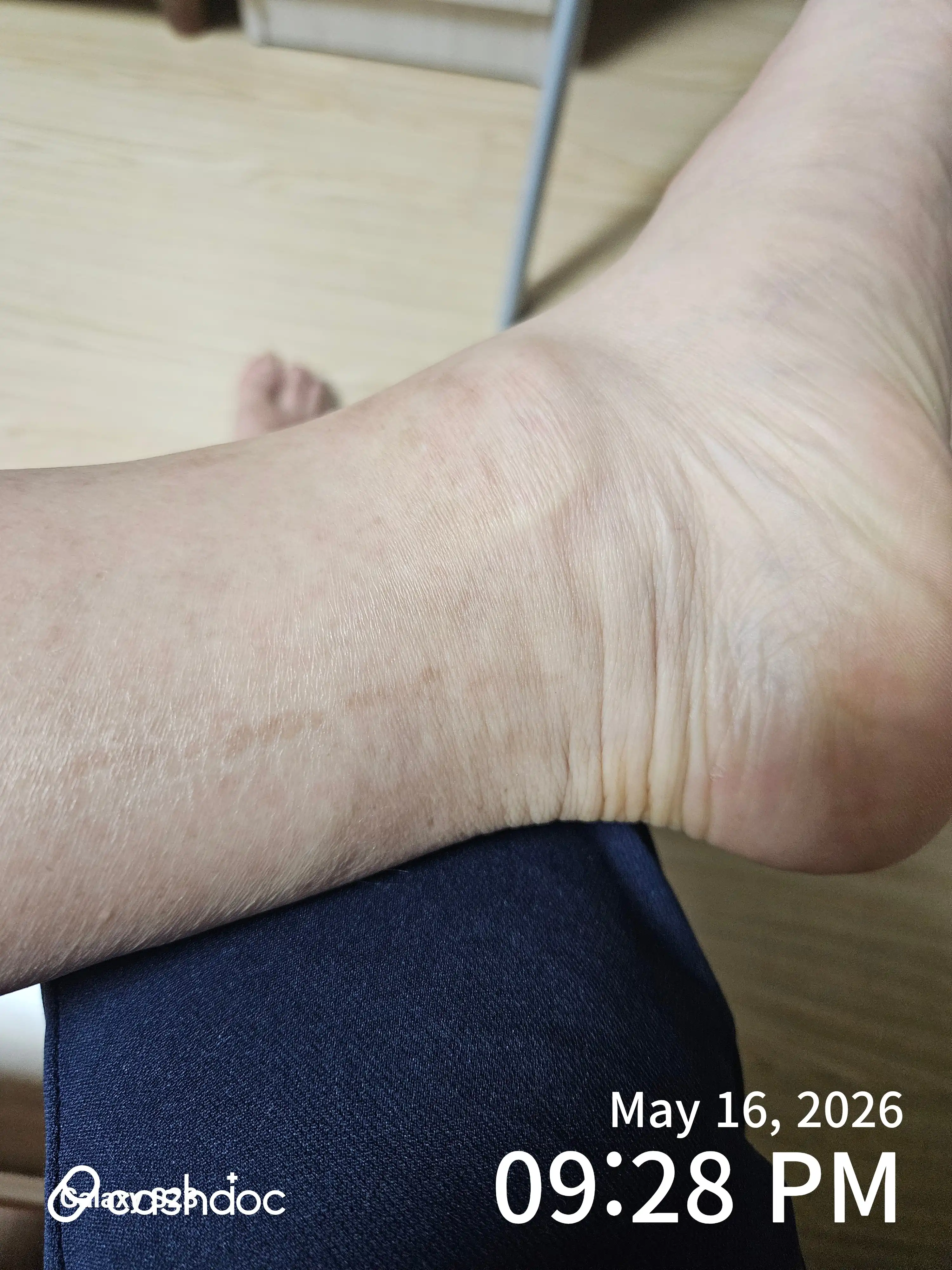 Review photo