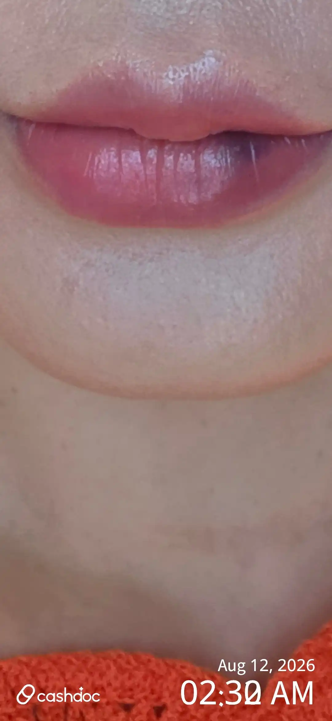 Review photo