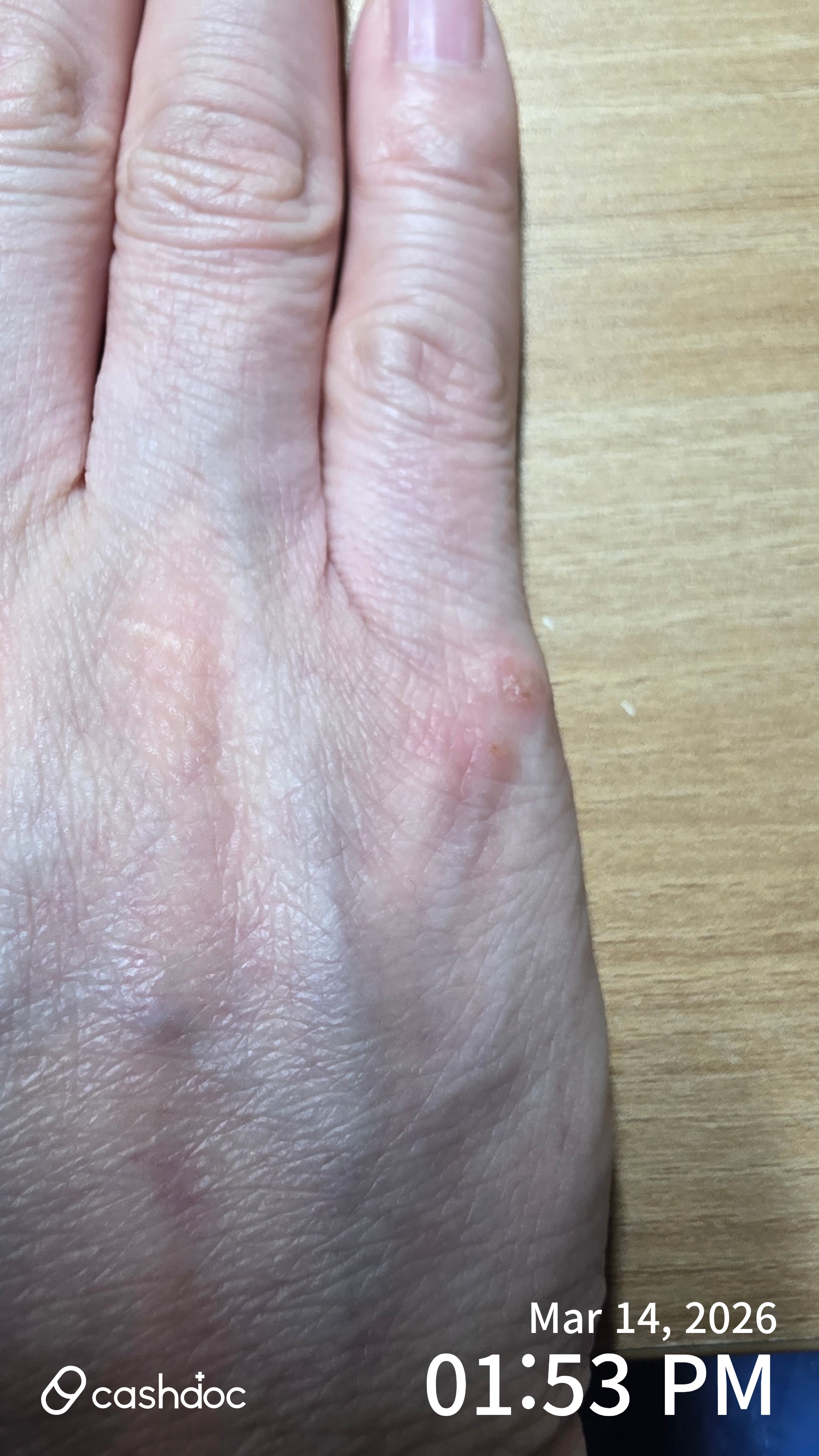 남동구 장피부과의원, 피부 트러블 해결 후기