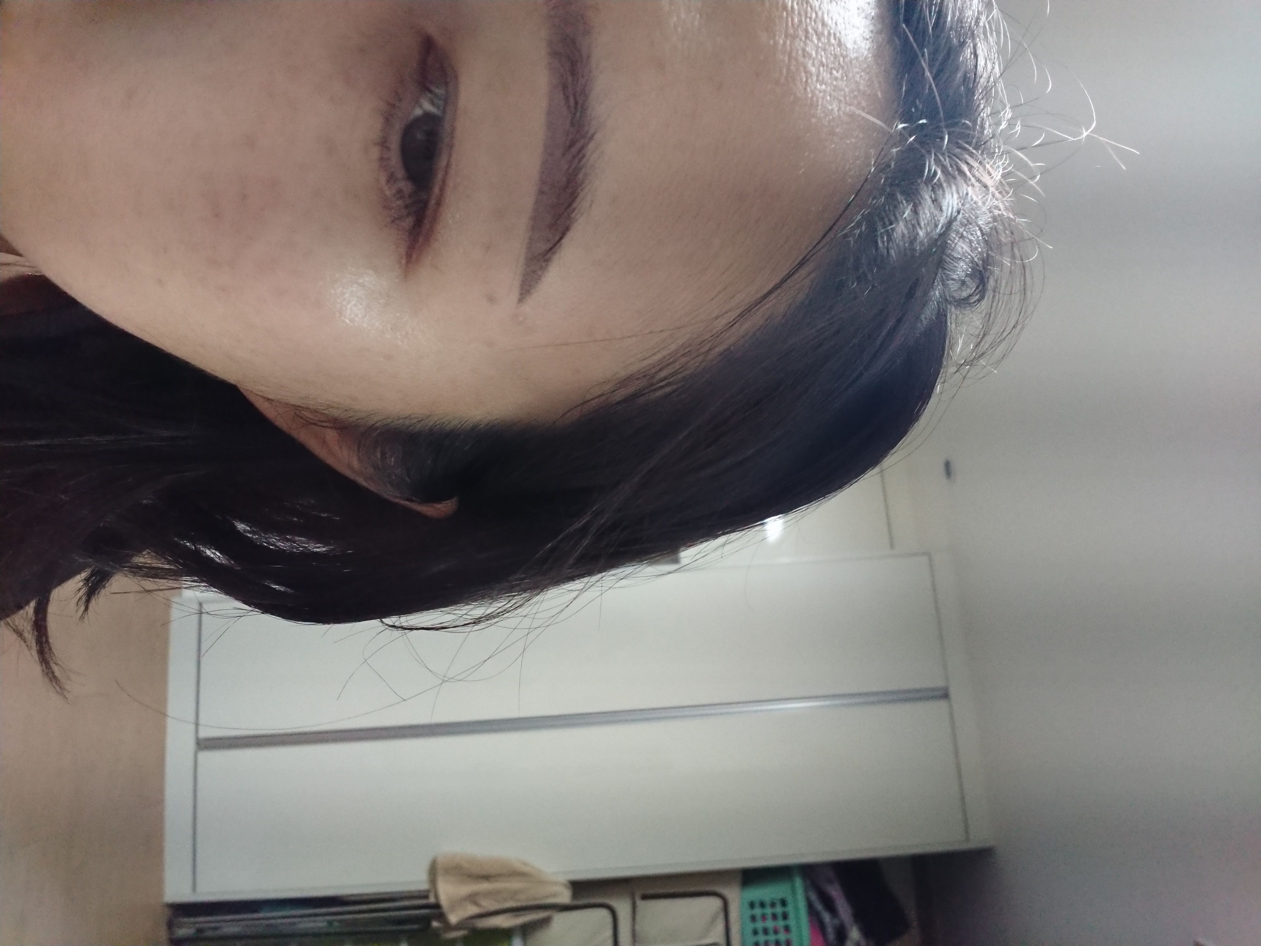 施術後 — 明るい肌を作る