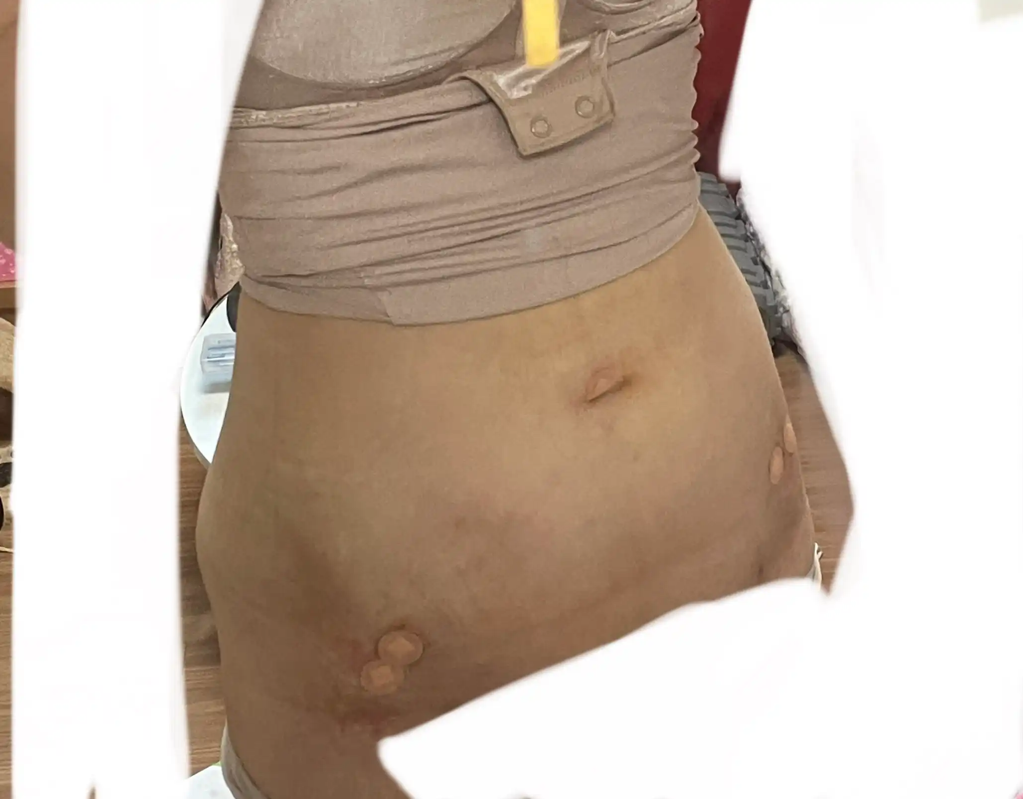 전