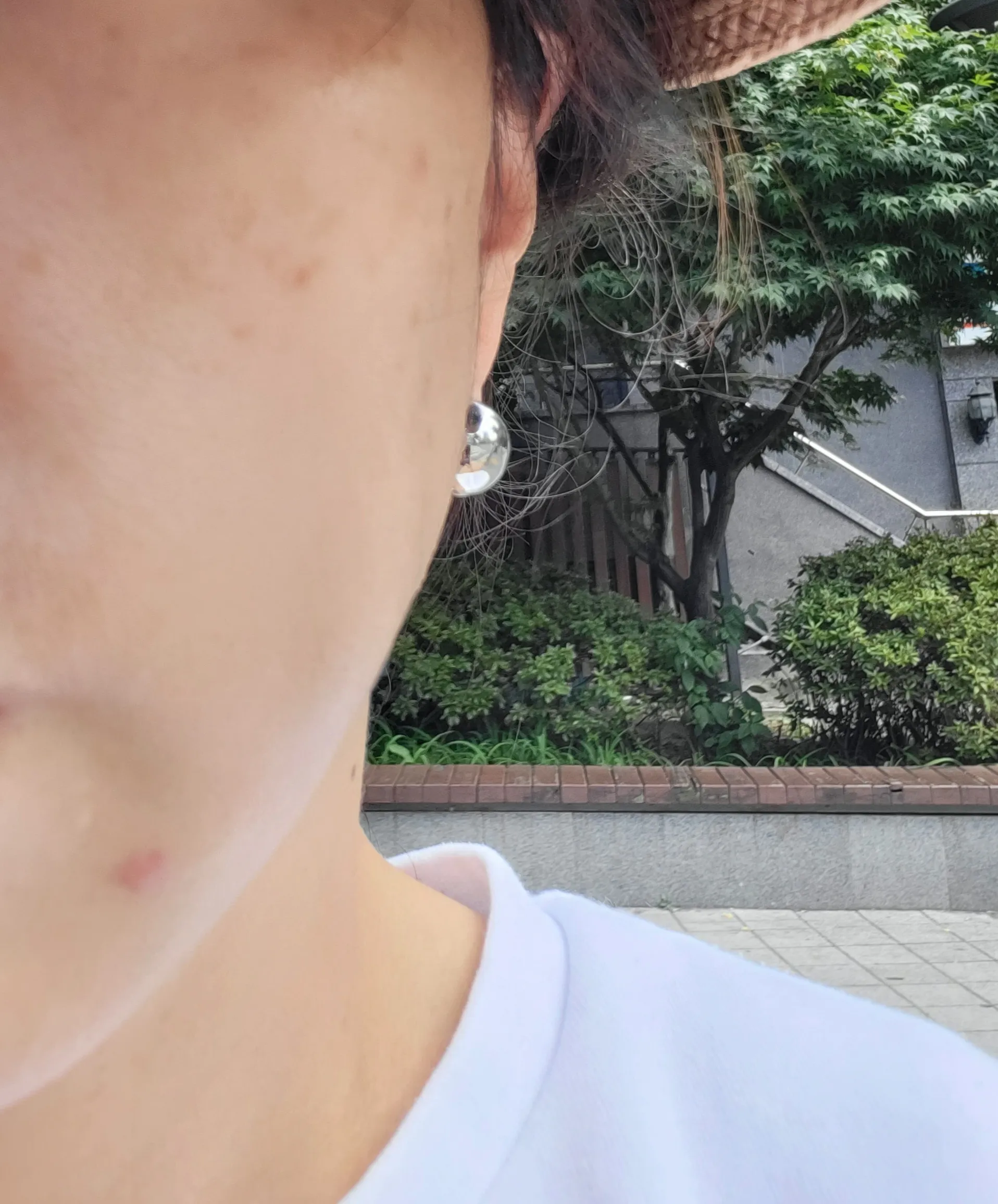 시술 전 — 비타민 미백관리