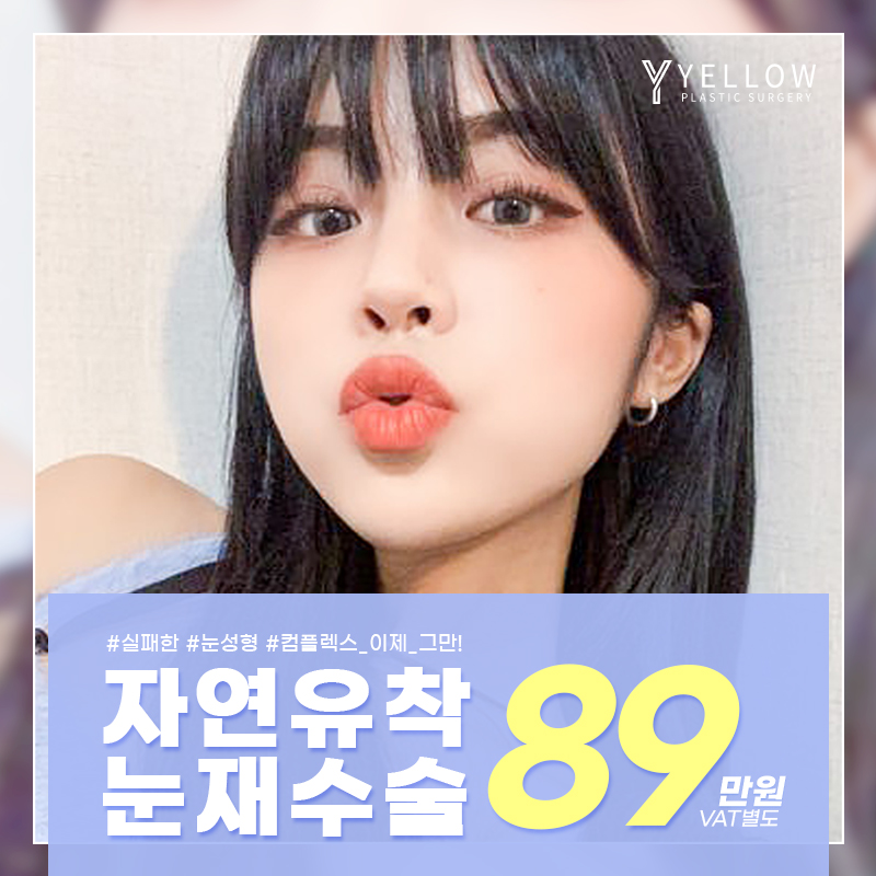 💛옐로우 눈재수술💛 이벤트 썸네일 이미지