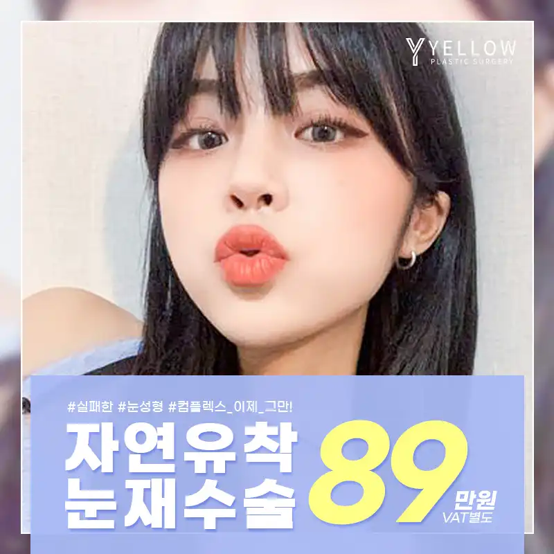 💛옐로우 눈재수술💛