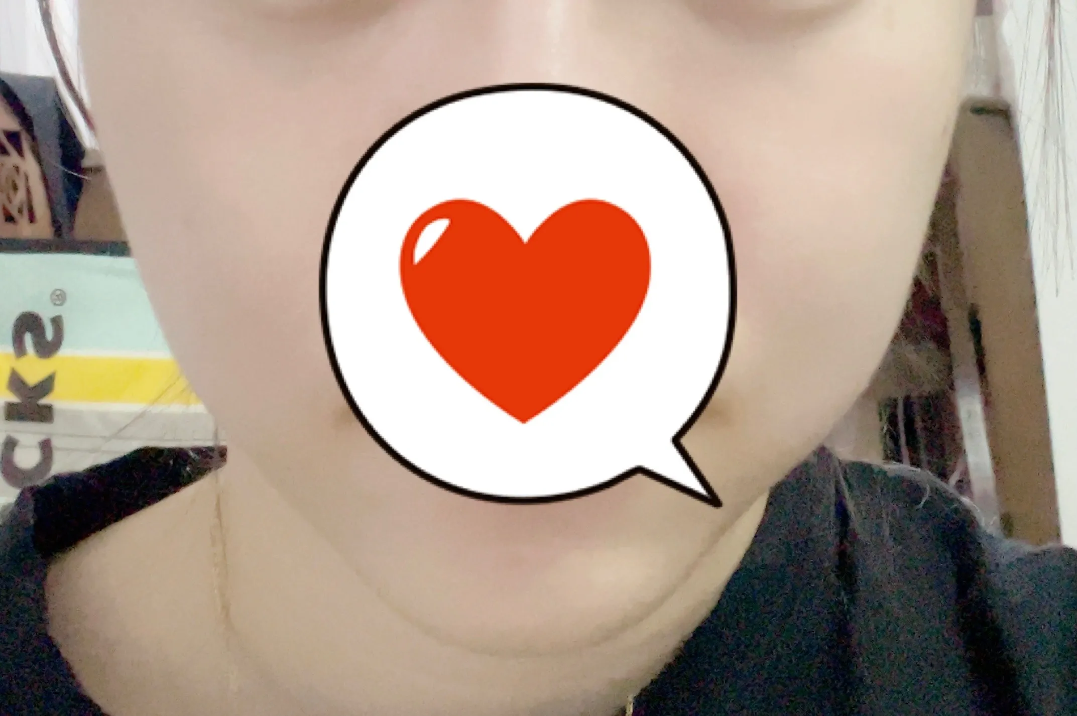 시술 전 — 인모드 리프팅