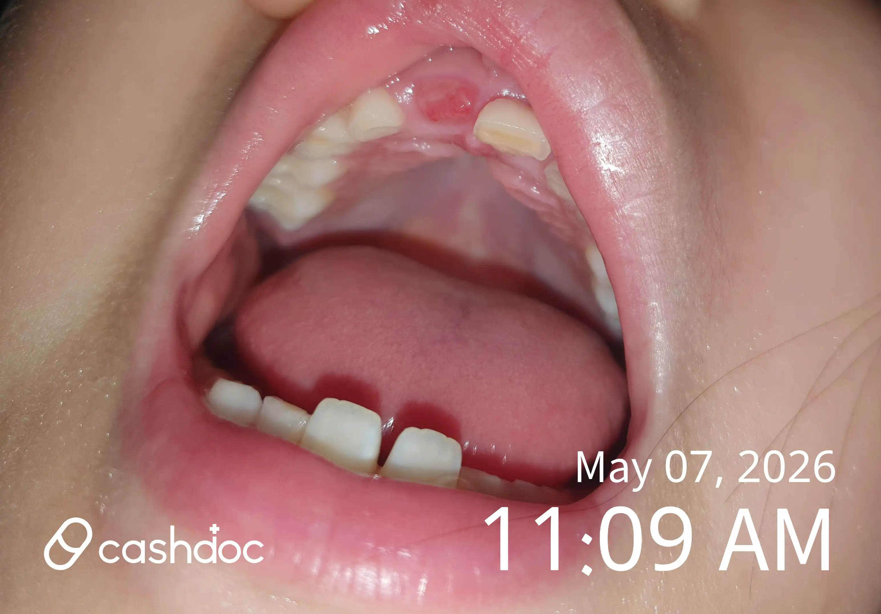 Review photo