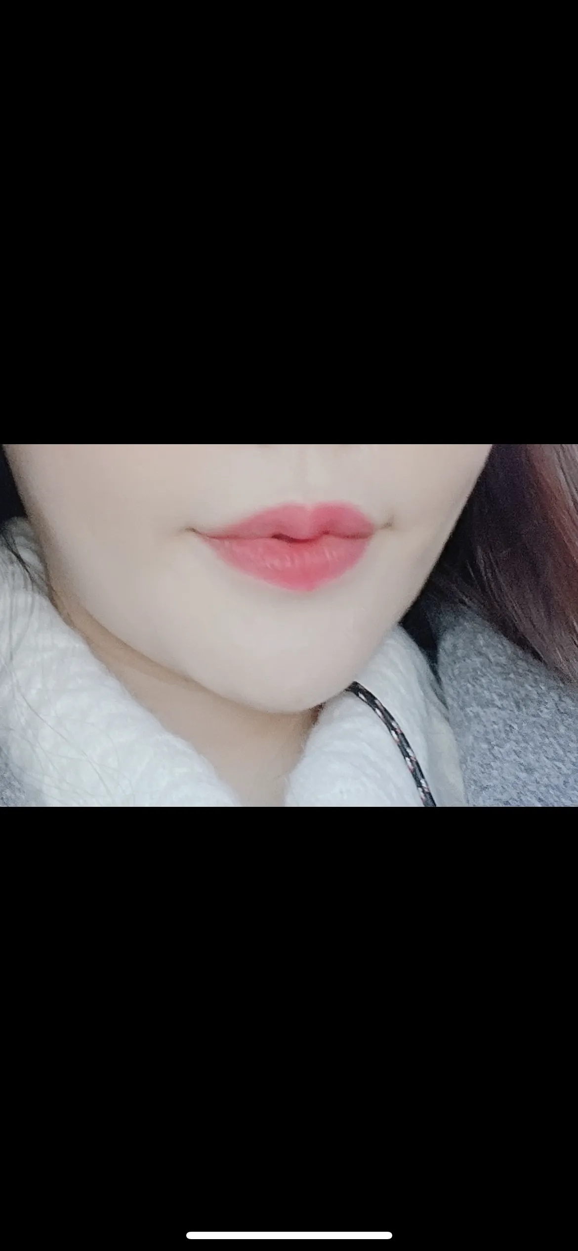 시술 전 — ★슈링크 100샷★ 처진얼굴UP