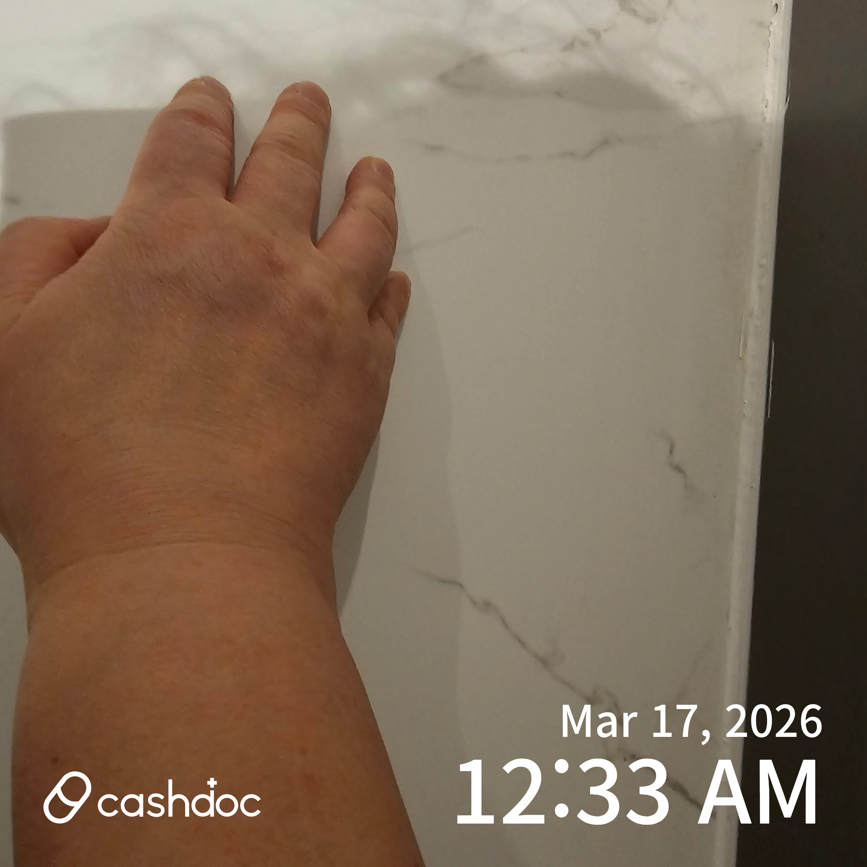 서초구 한아름한의원, 통증 치료 후기: 현진우 선생님 덕분에 완화됐어요!