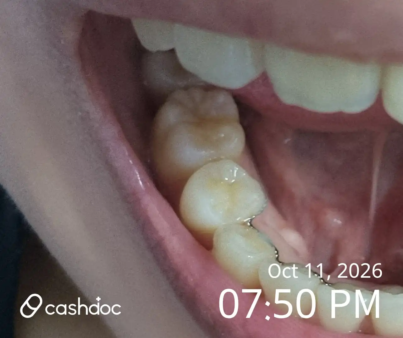 Yonsei Spring Dental Clinic review photo