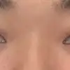 前