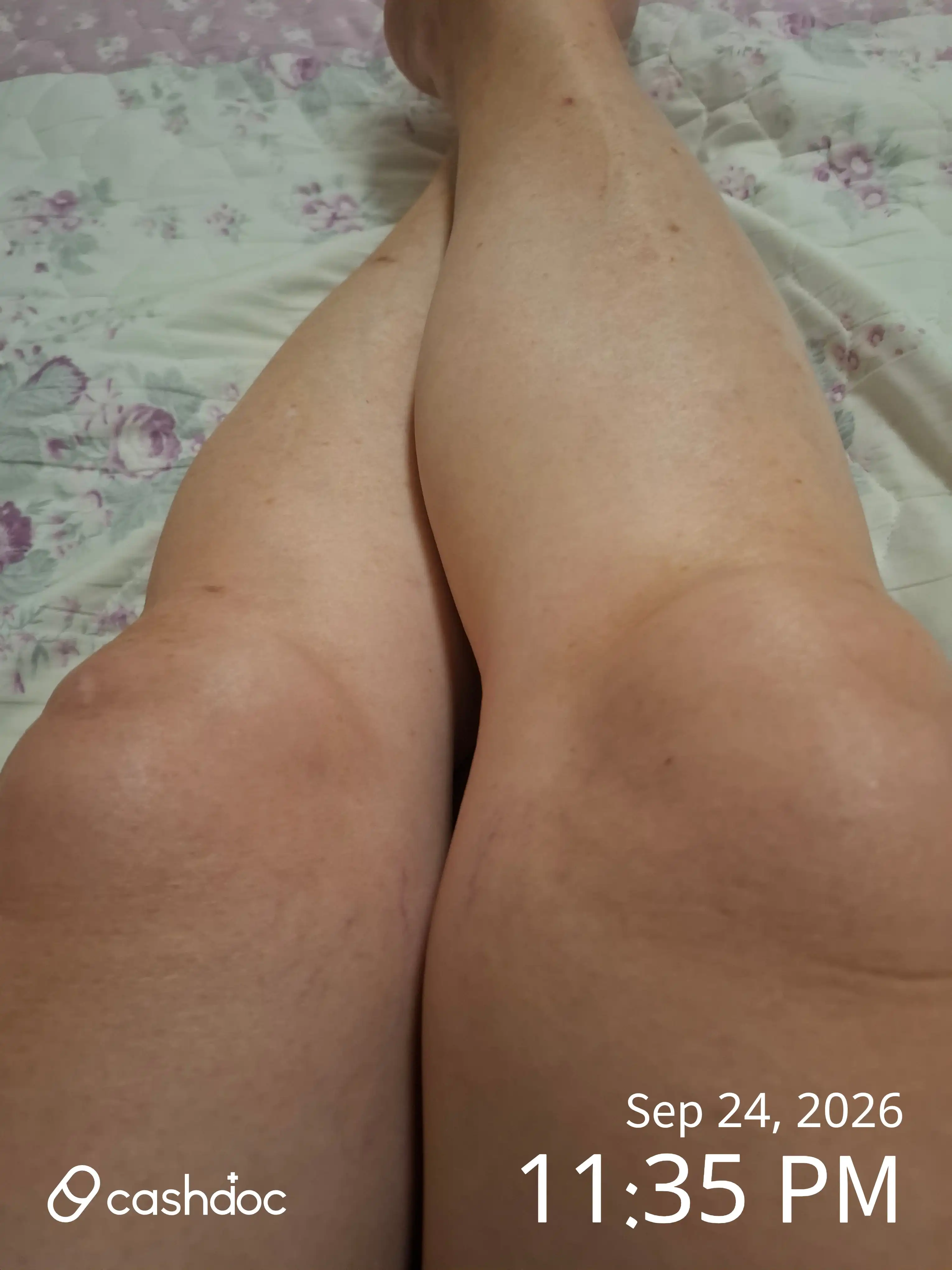 Review photo