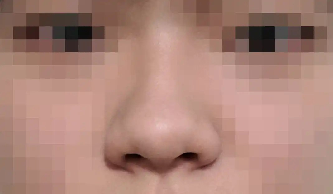 전