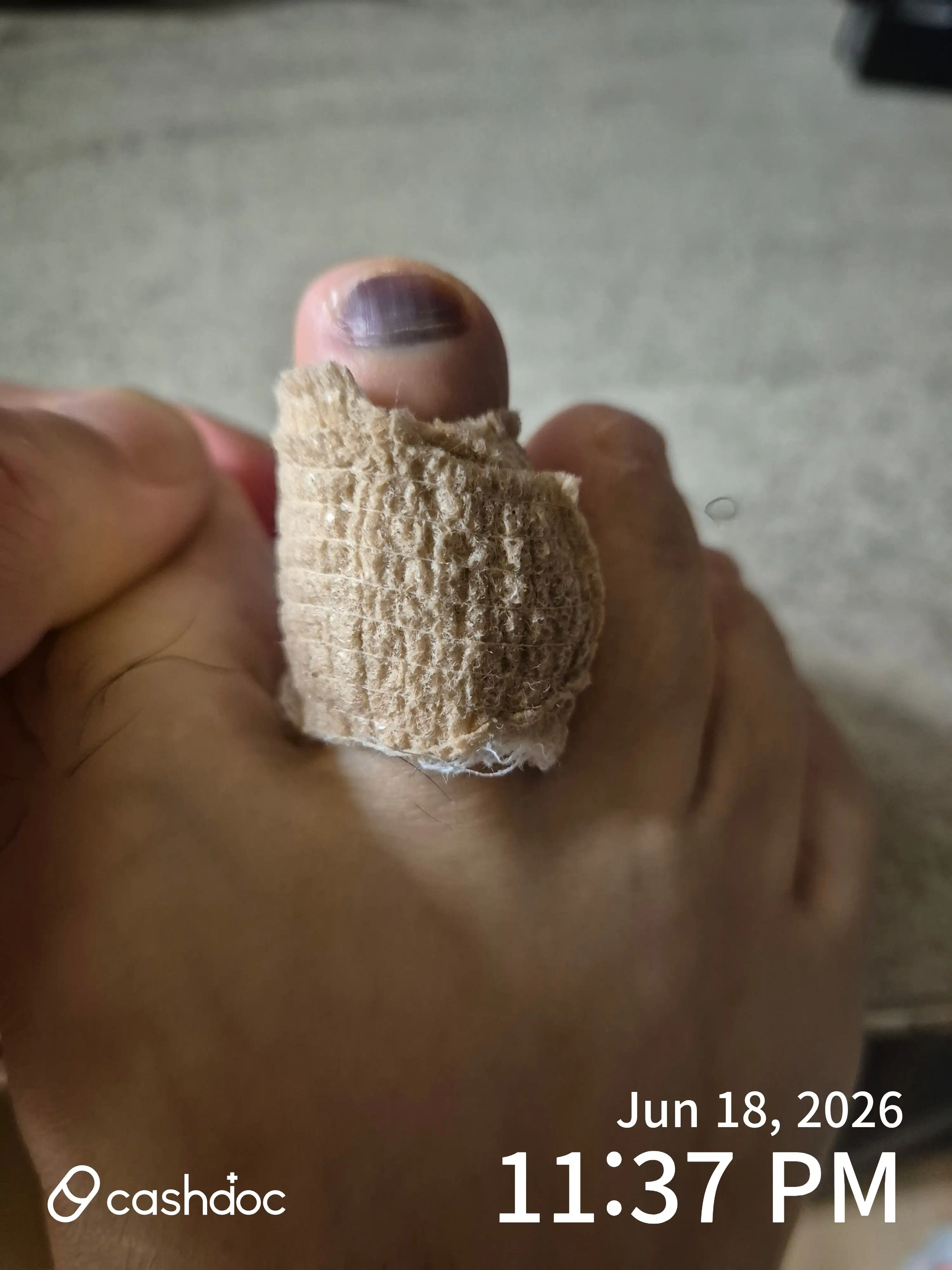 Review photo