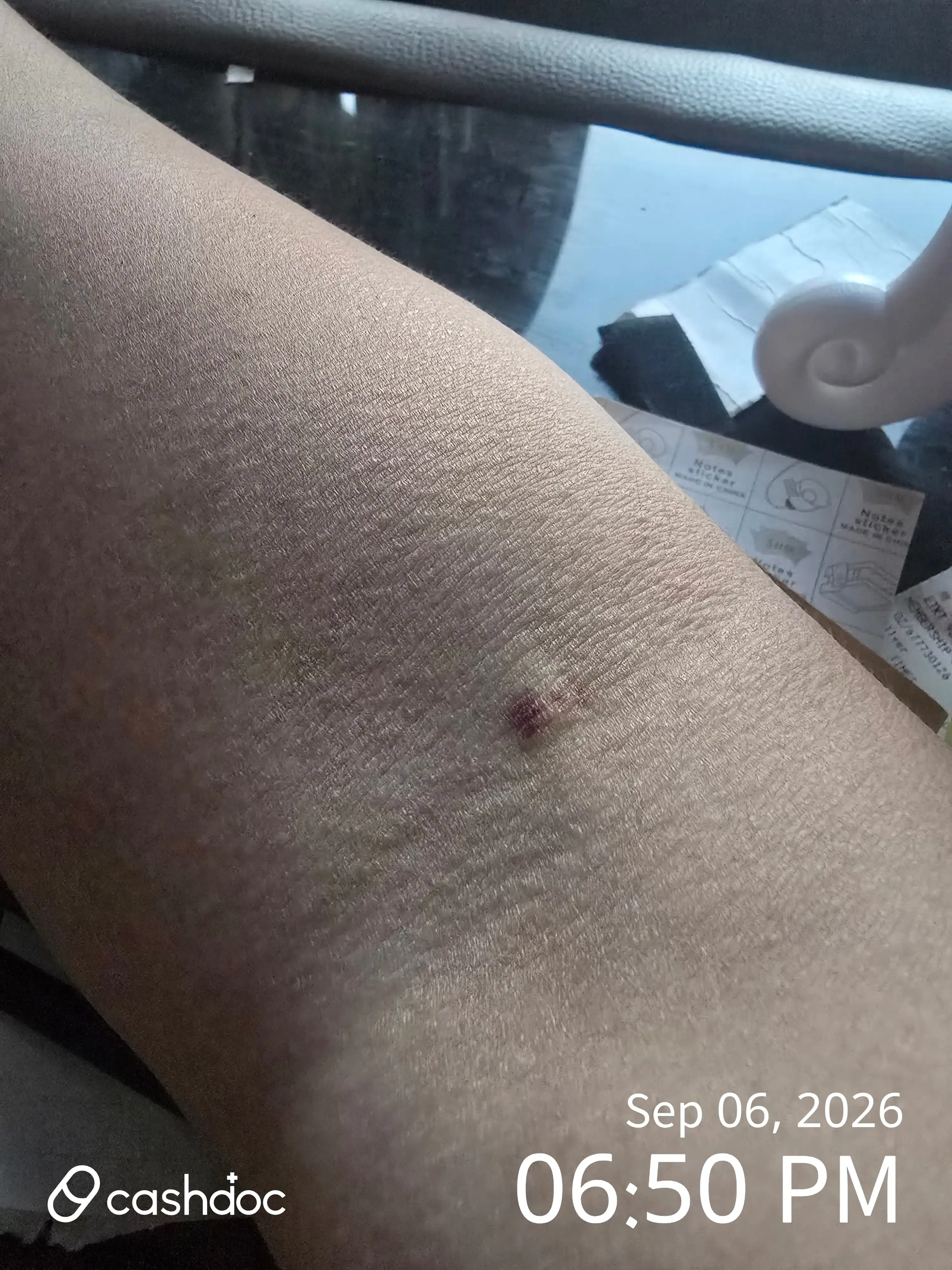 Review photo
