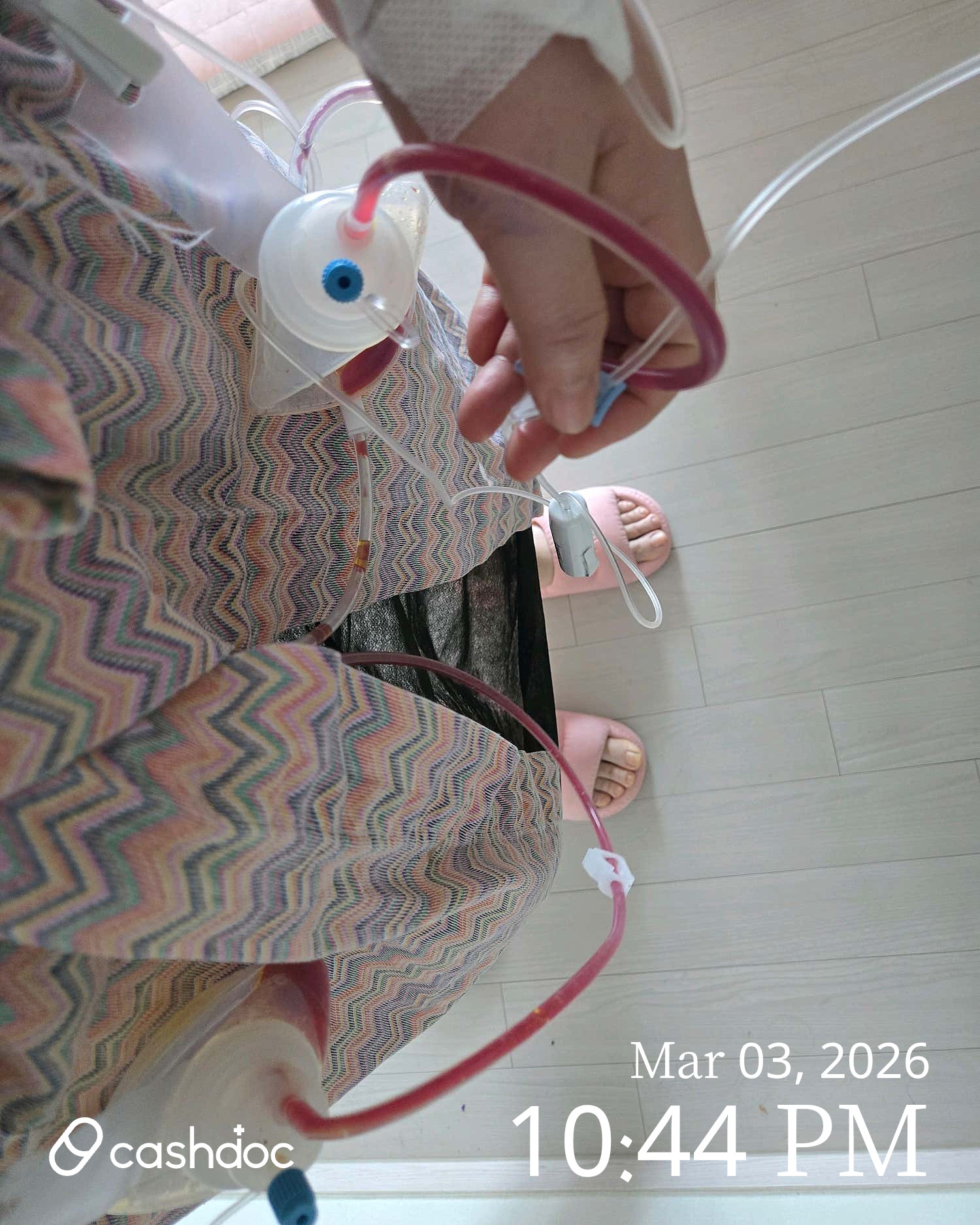 강남구 글로비성형외과에서 받은 지방흡입, 대만족 결과!