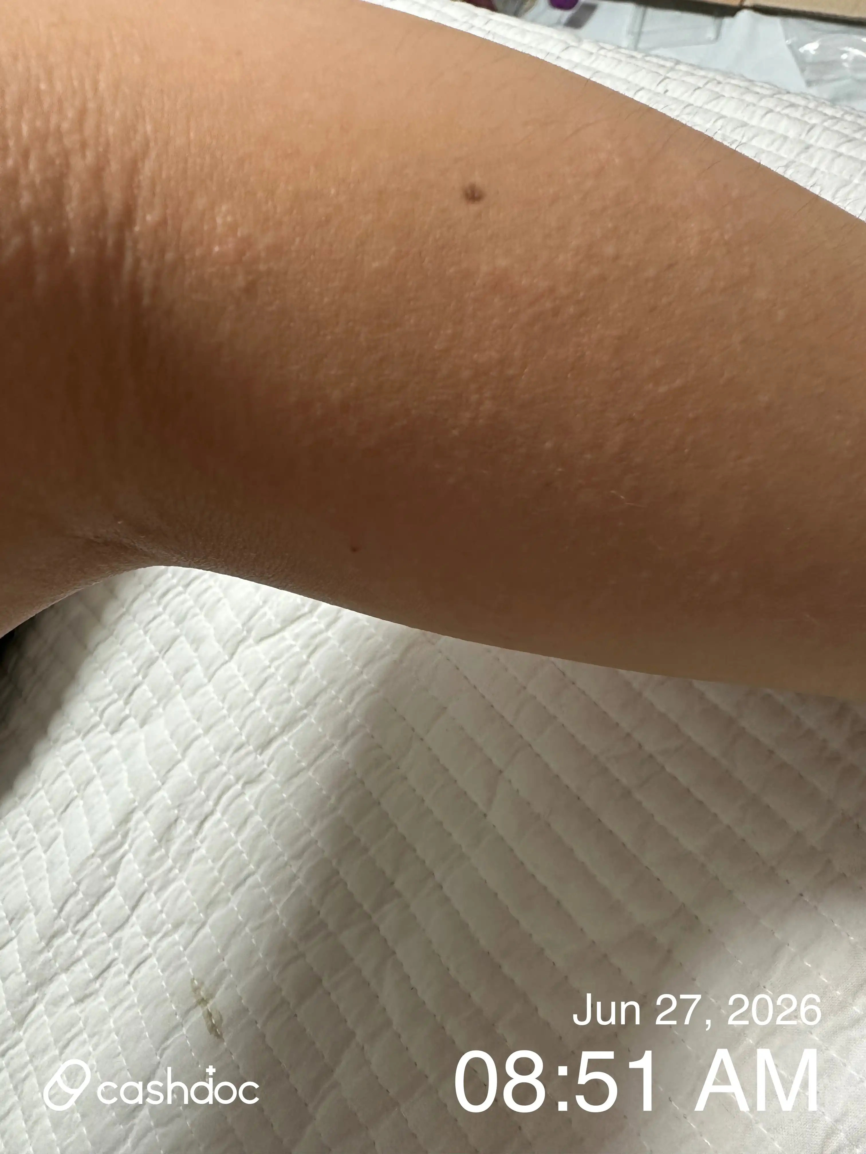 评价照片