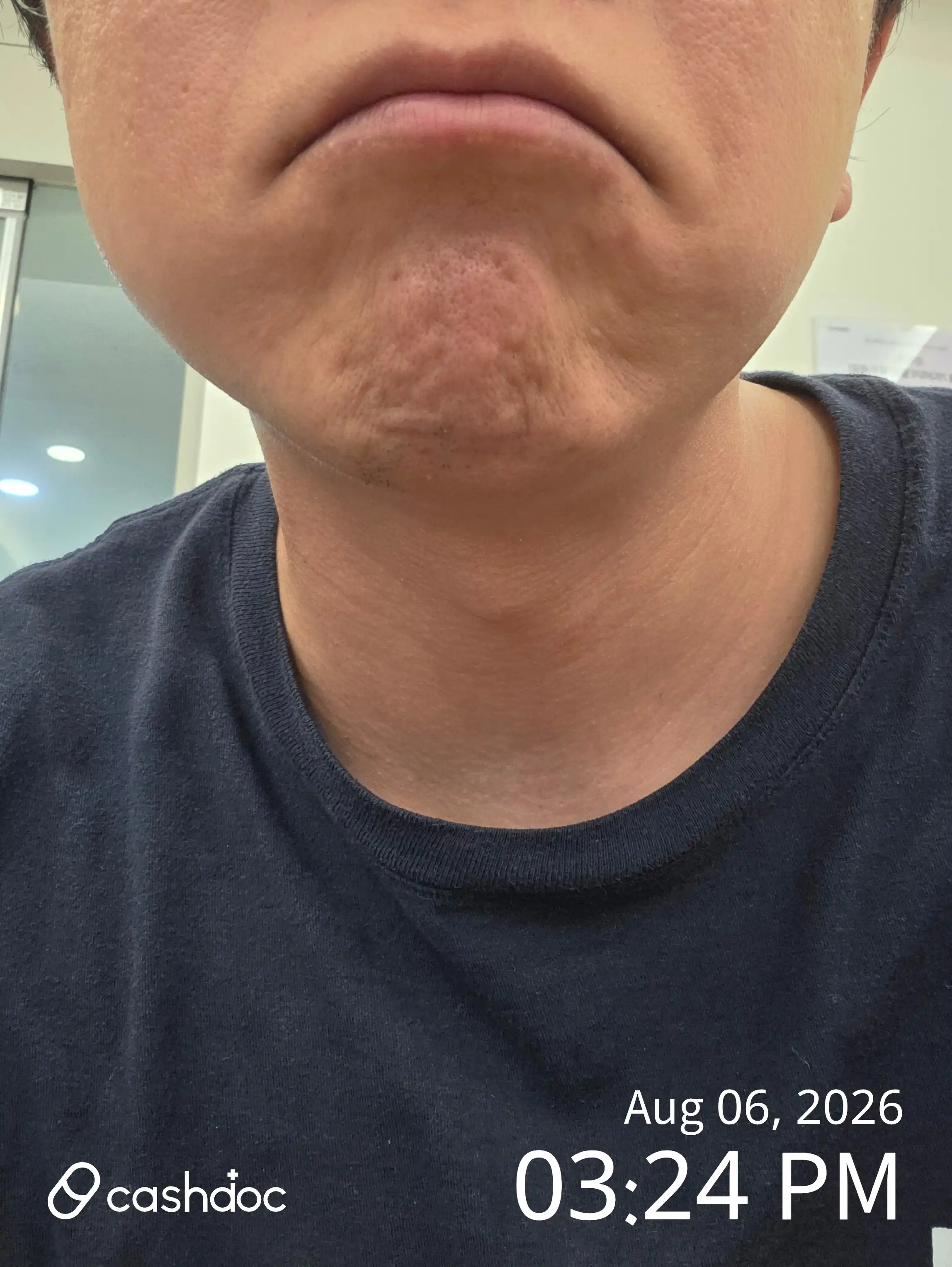 评价照片