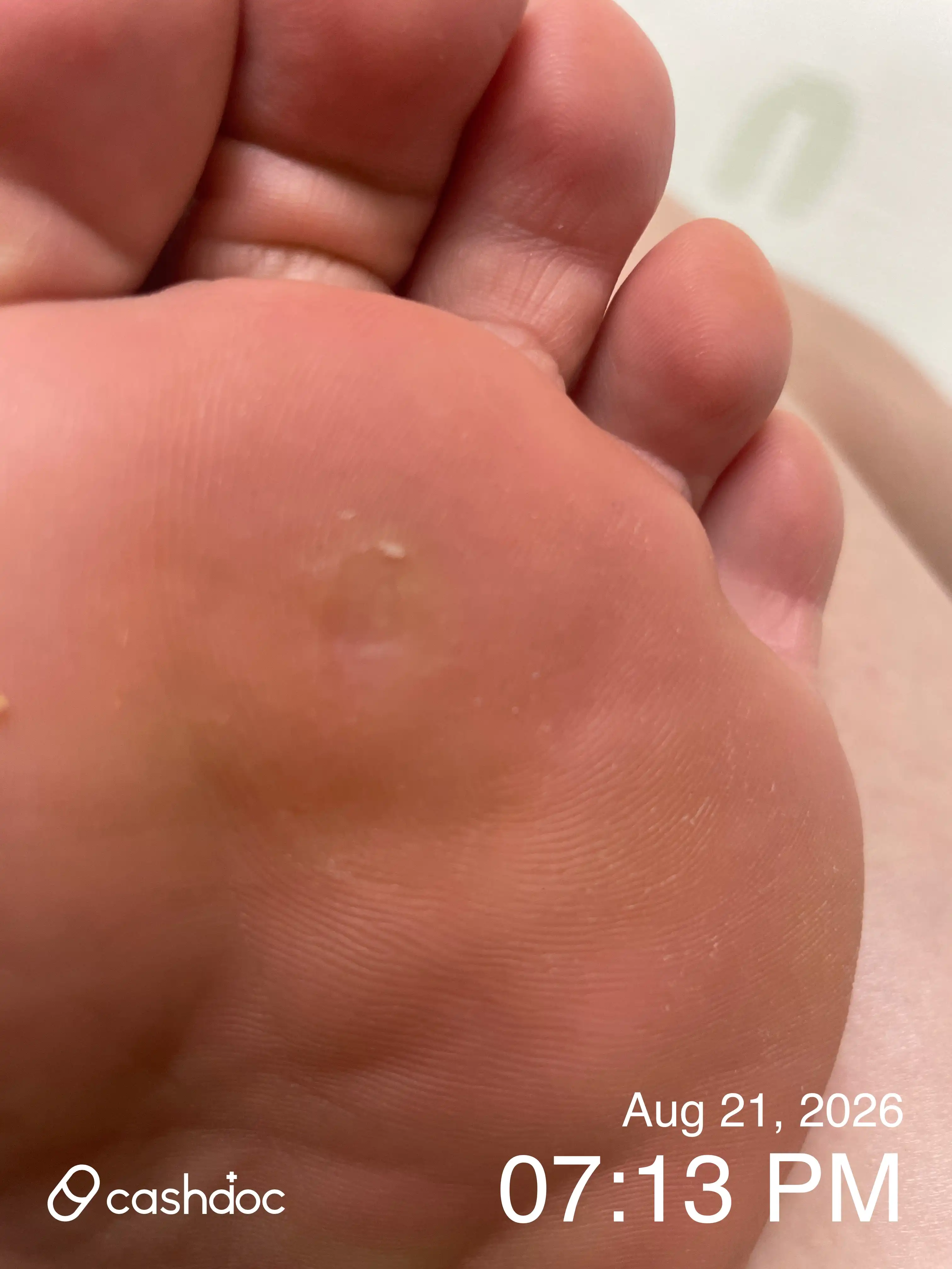评价照片
