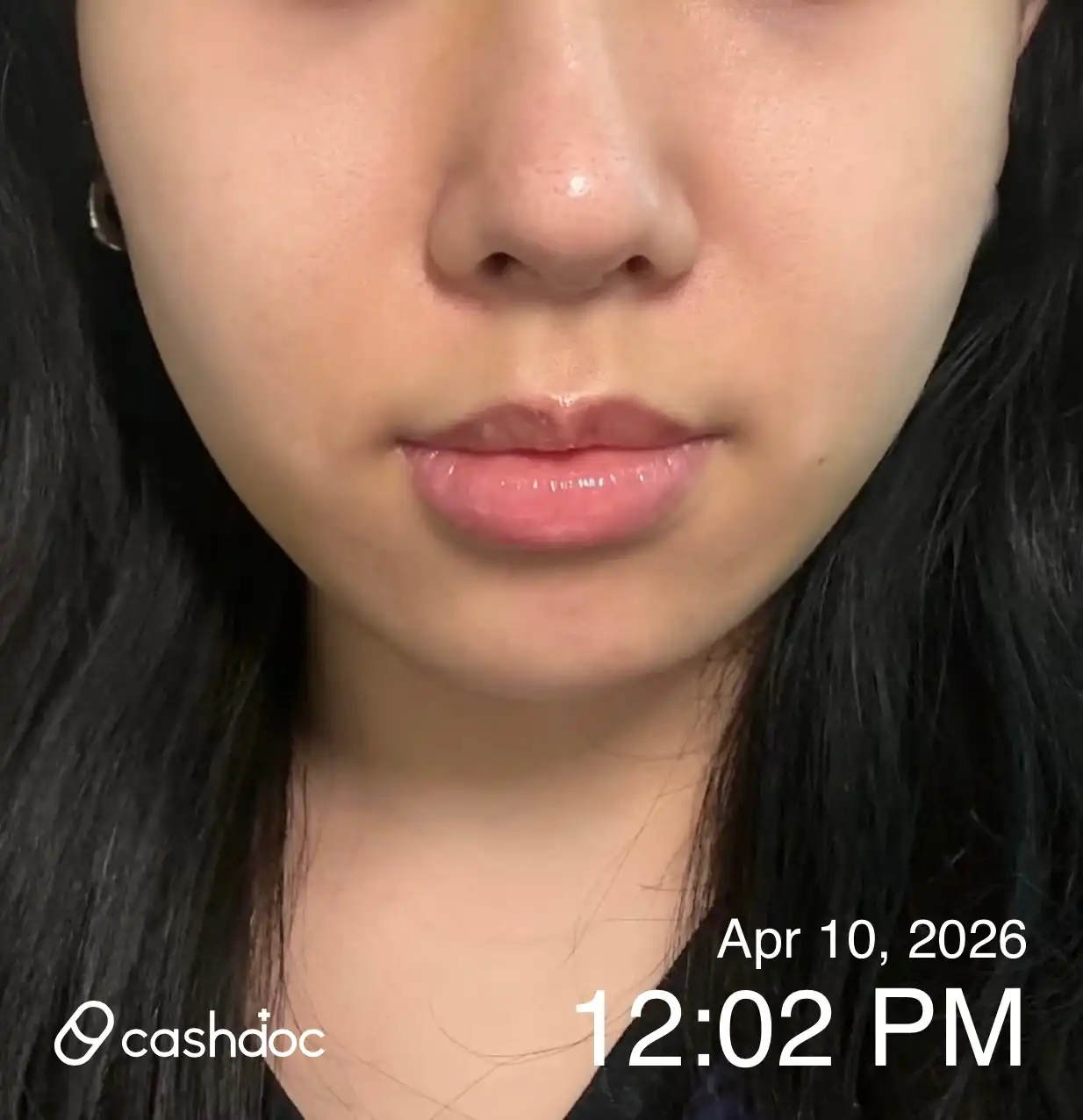 评价照片