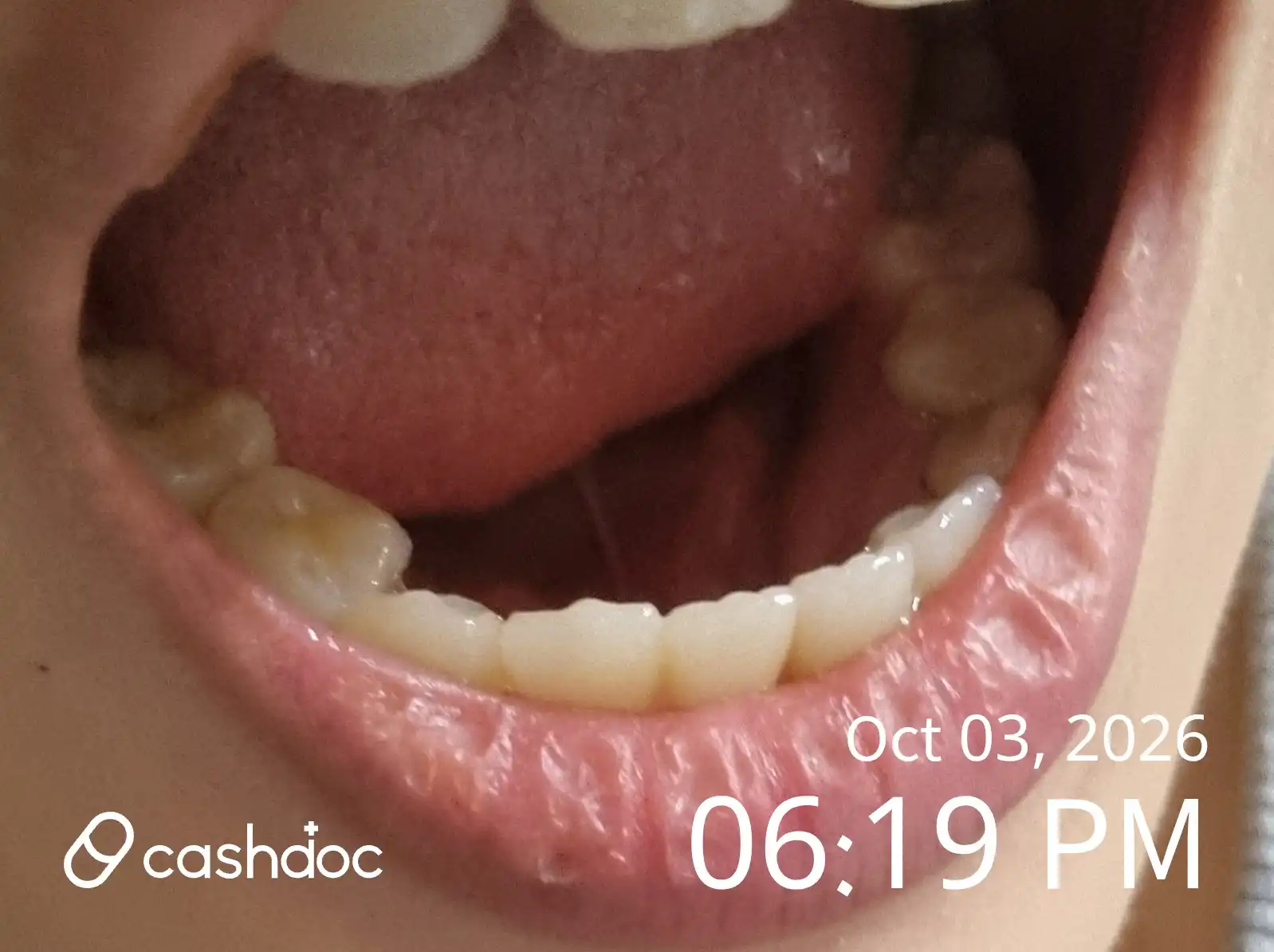 Review photo