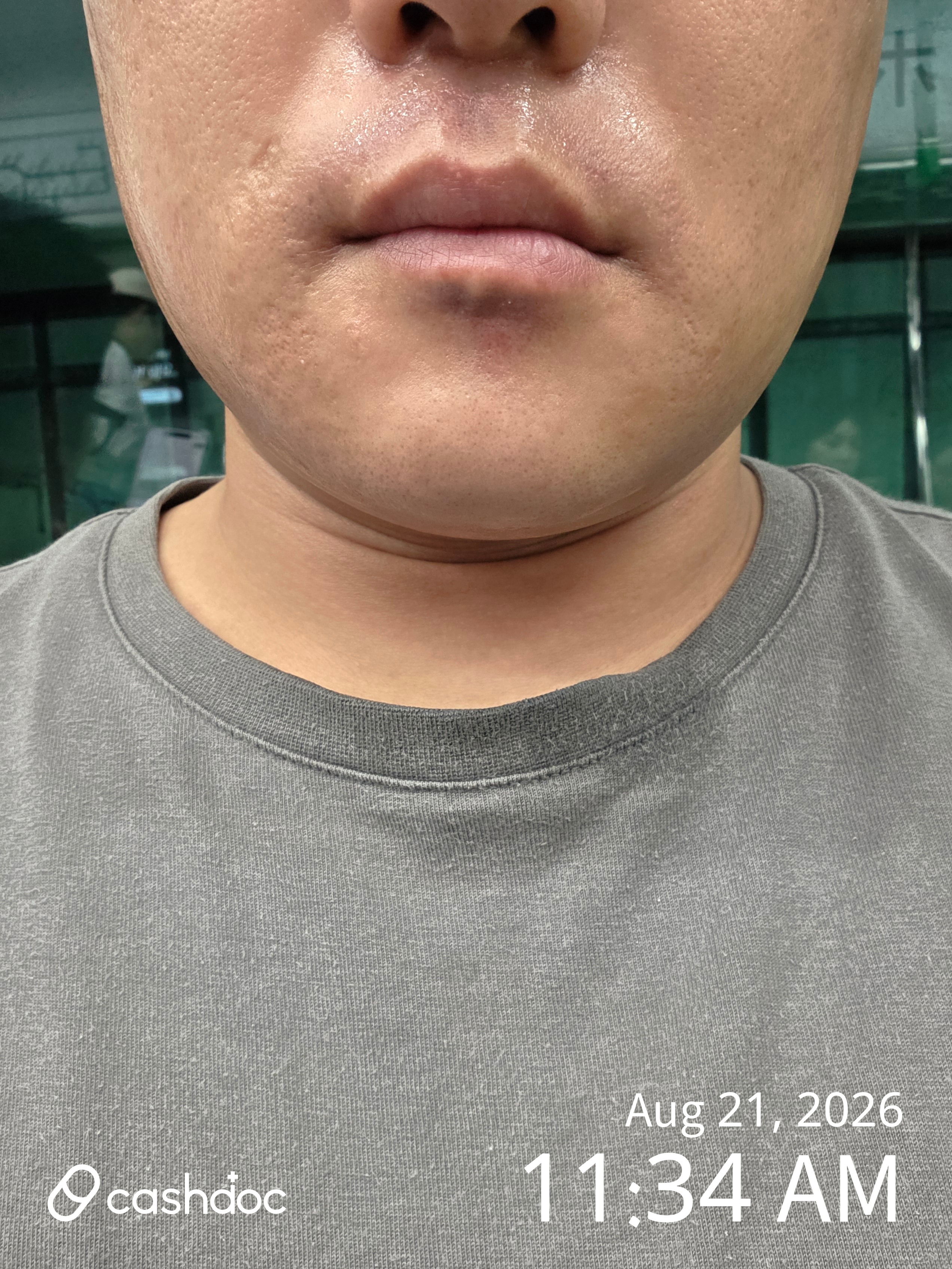 Review photo