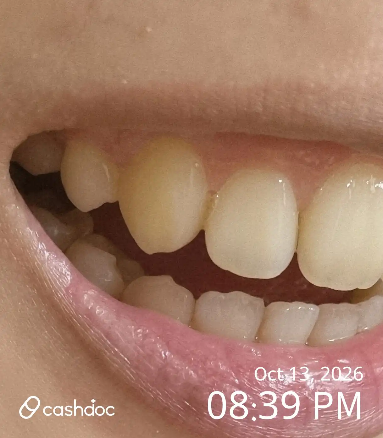 Seoul Samsung Dental Clinic review photo