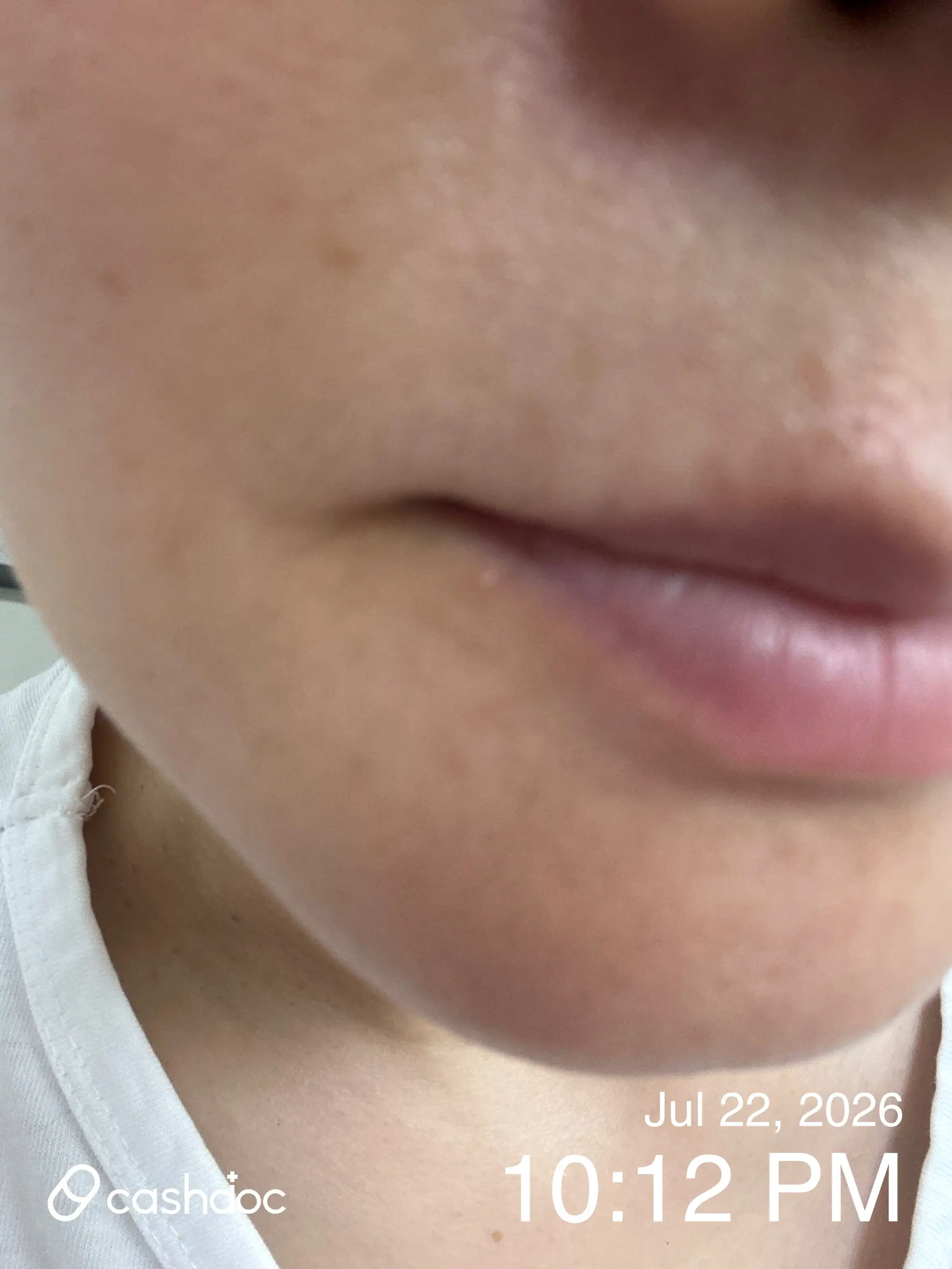 评价照片