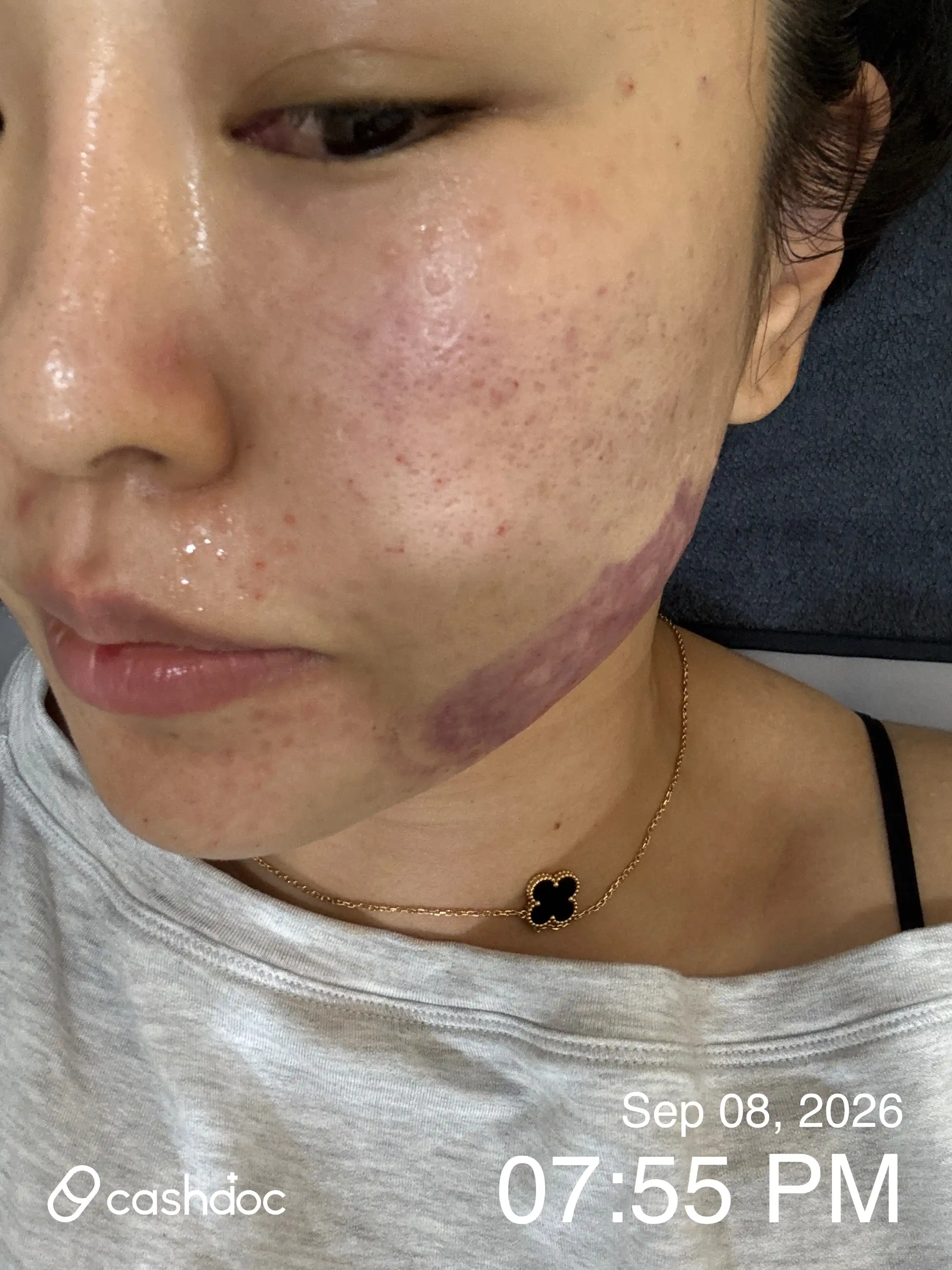 评价照片
