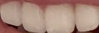 후