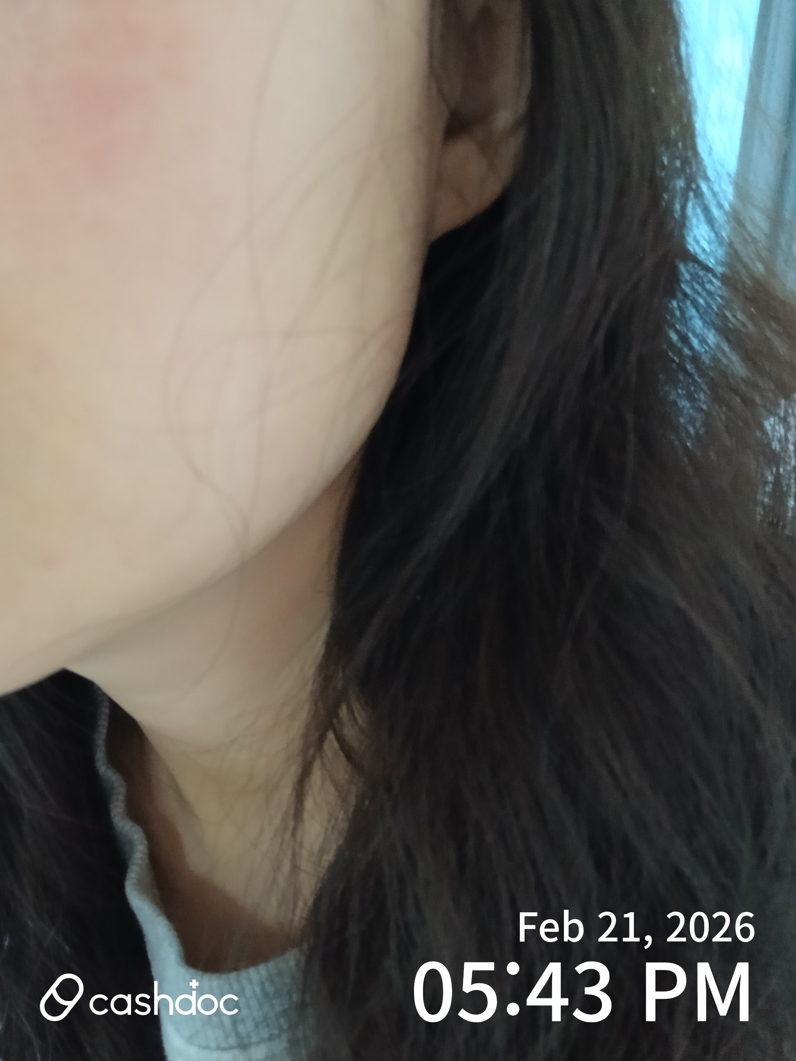 남양주시 메이퓨어의원 평내호평점, 엄마와 함께한 보톡스 상담 후 엑소좀까지!