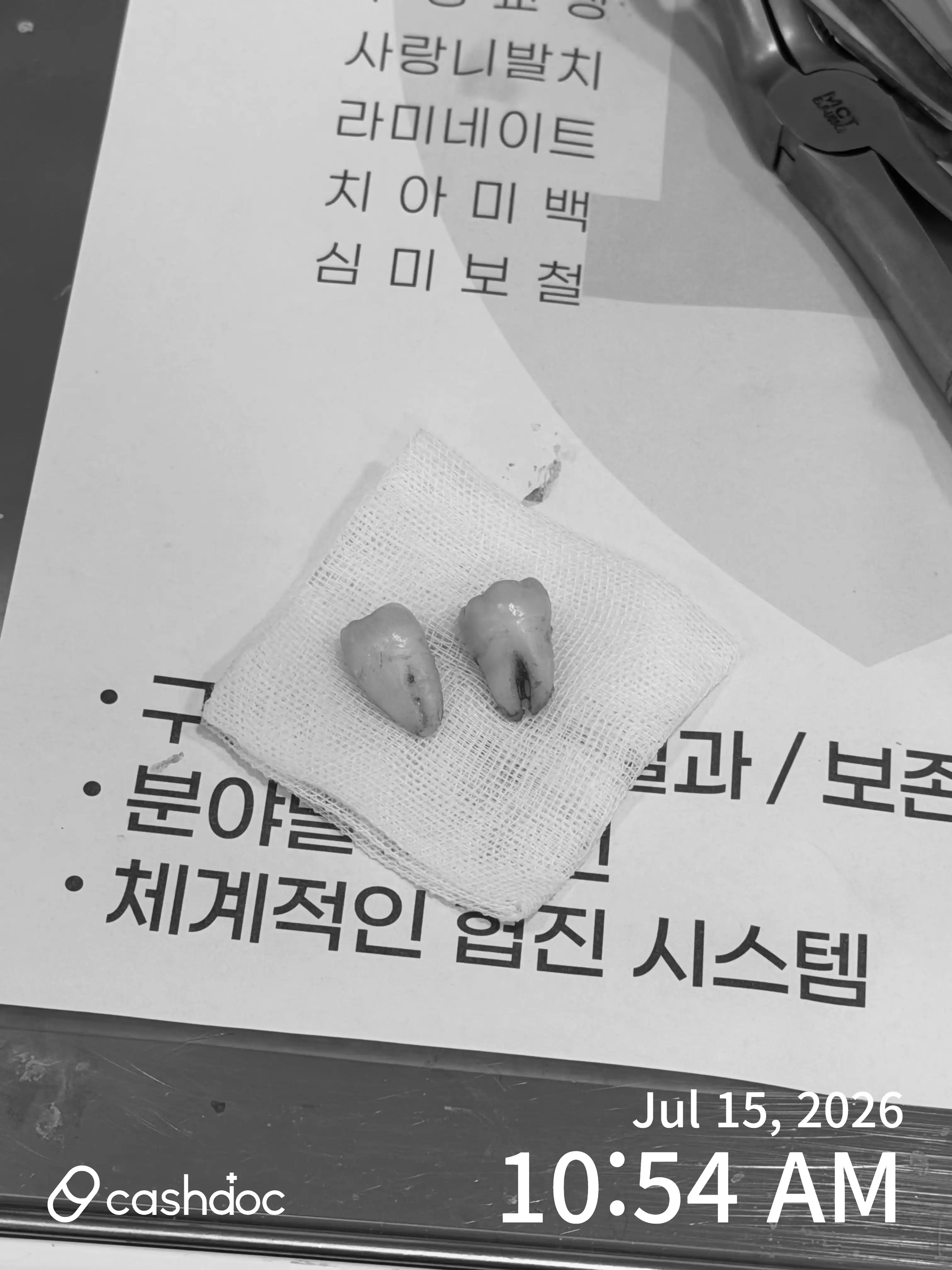 후기 사진