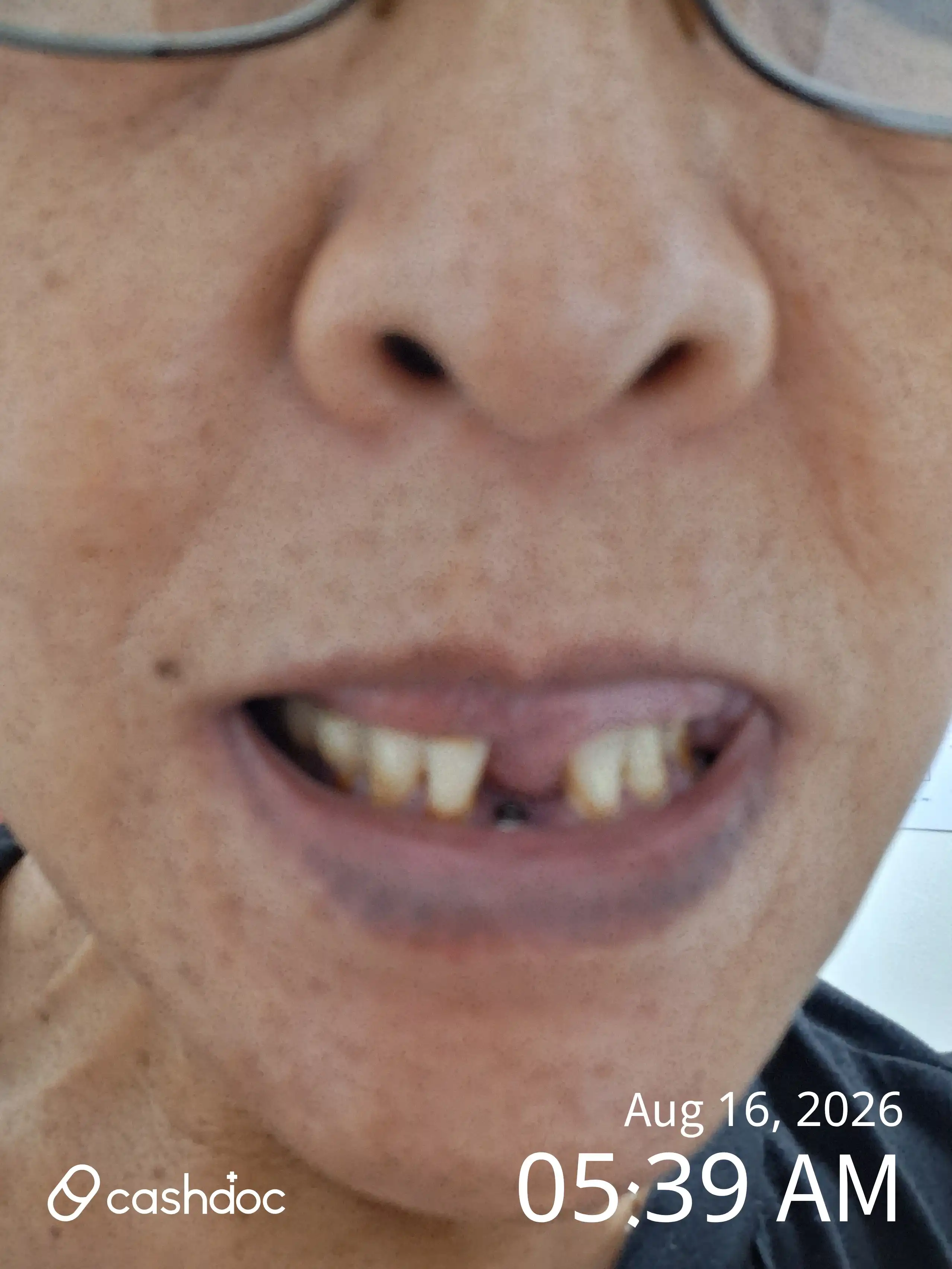 评价照片