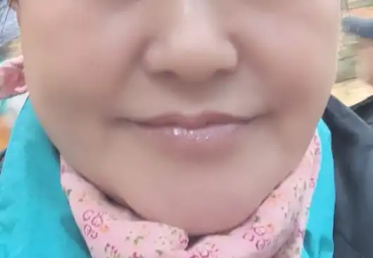 전