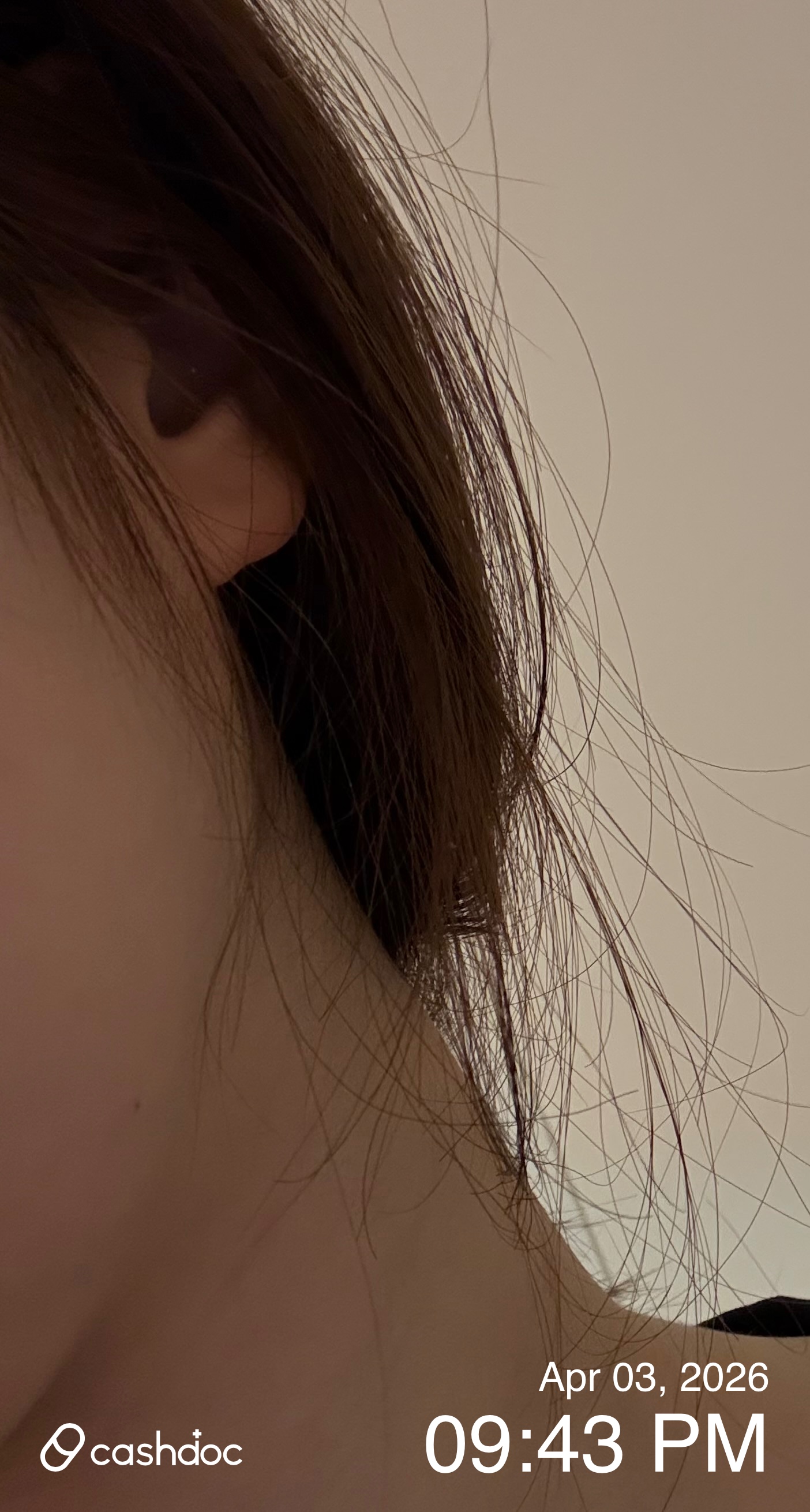 강동구 갤러리아피부과, 턱라인 개선 시술 경험 후기