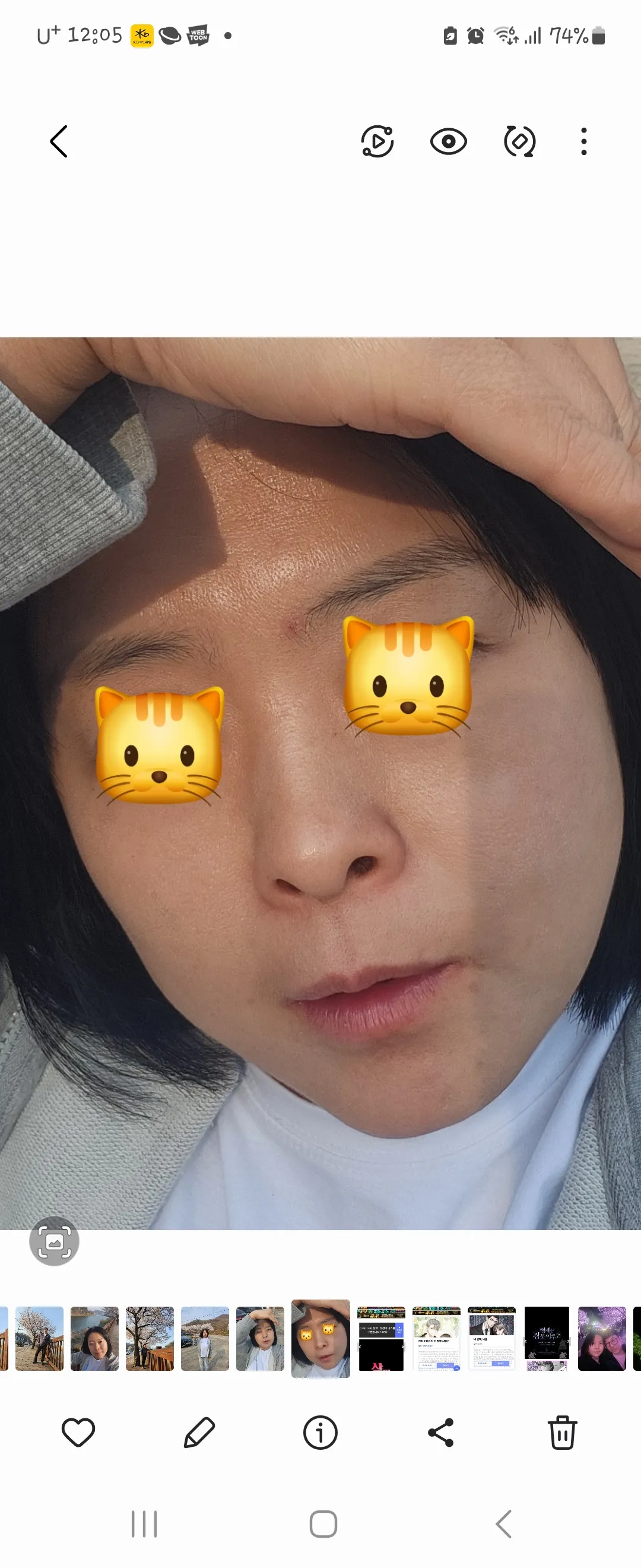 시술 전 — 자연과한의원 다이어트 지방사약 처방