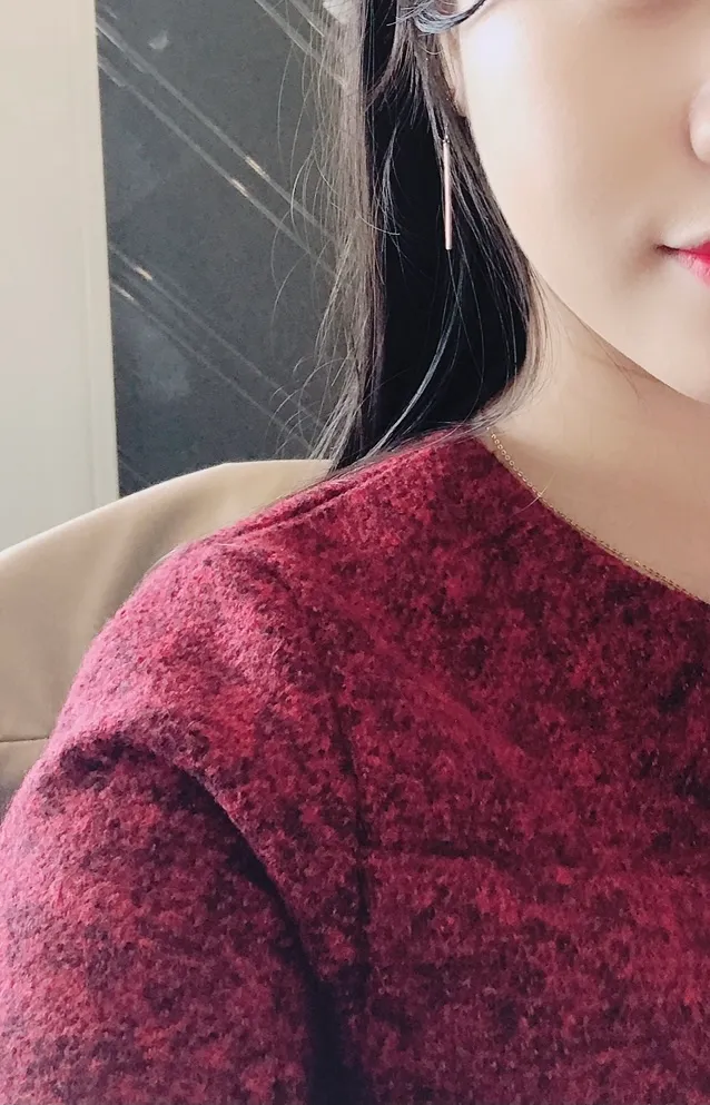 시술 후 — 싸이토케어 (에르메스주사)