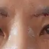 후
